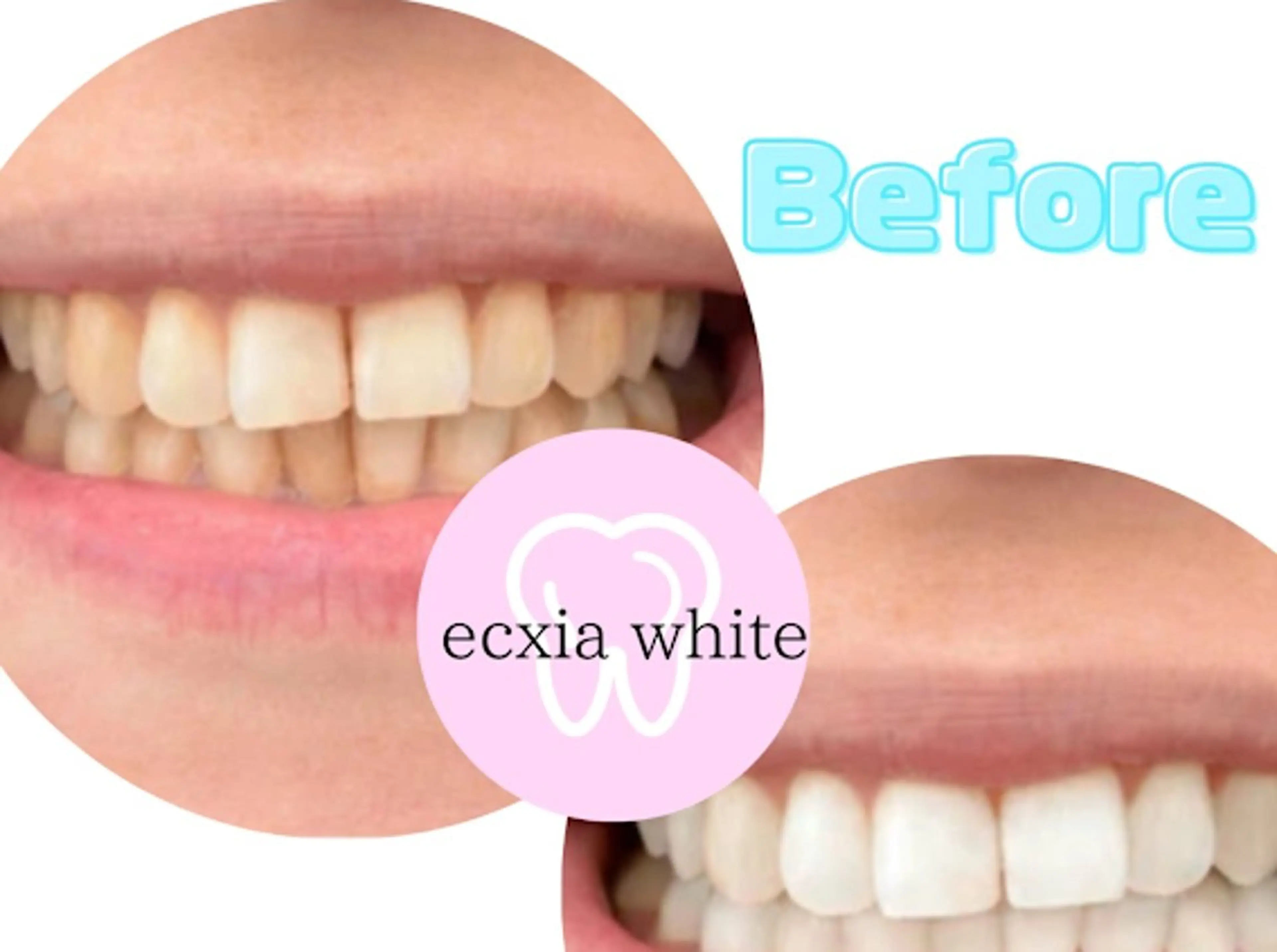 セルフホワイトニングサロン　エクシアホワイト西尾店所属・エクシアホワイト西尾 堀内恵のその他イメージ