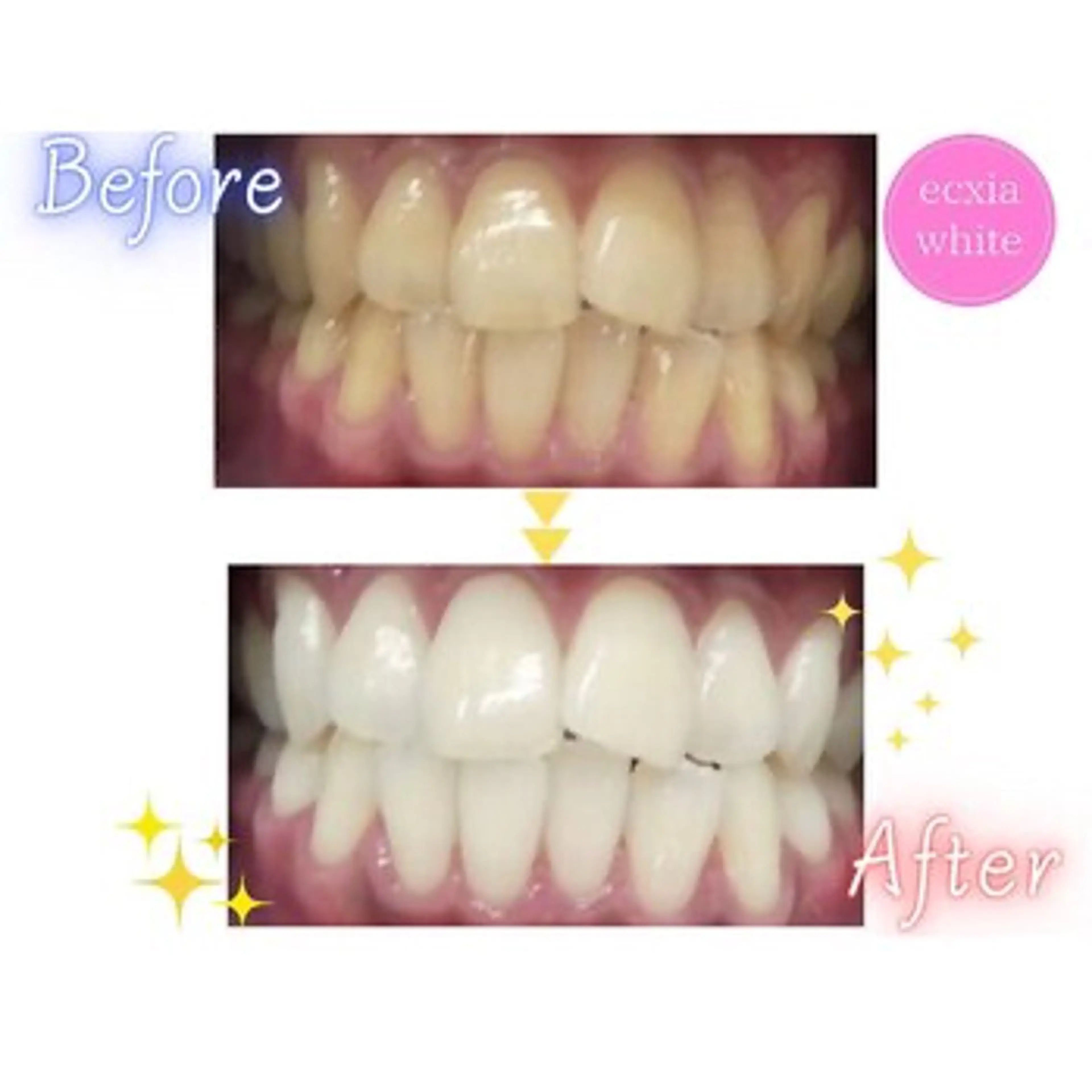 エクシアホワイトニング武蔵小杉店所属・セルフホワイトニング エクシア武蔵小杉店のその他イメージ