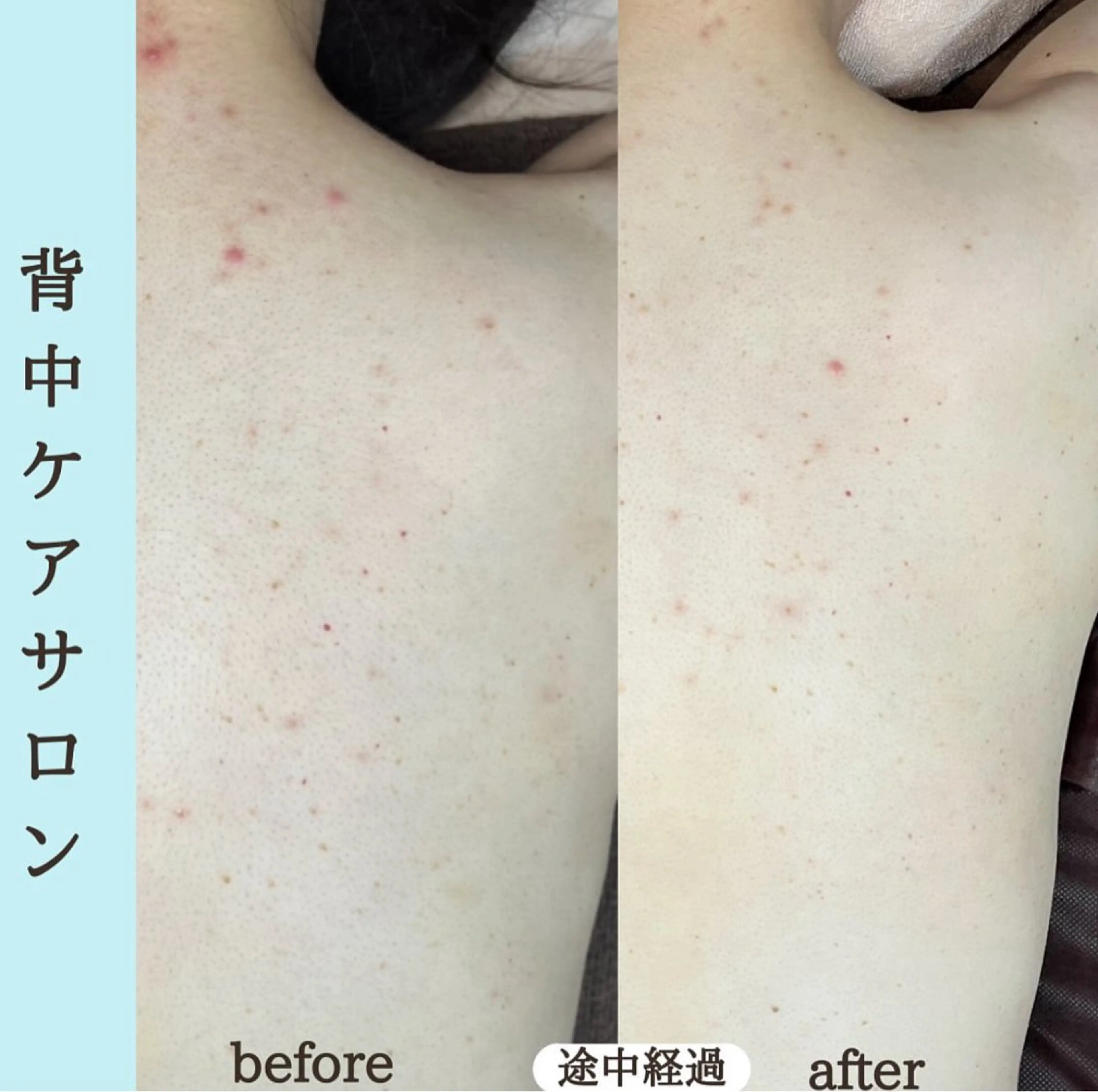 エステ ベラージュ【美背中・ 美尻・フェイシャル】のエステ・リラクイメージ