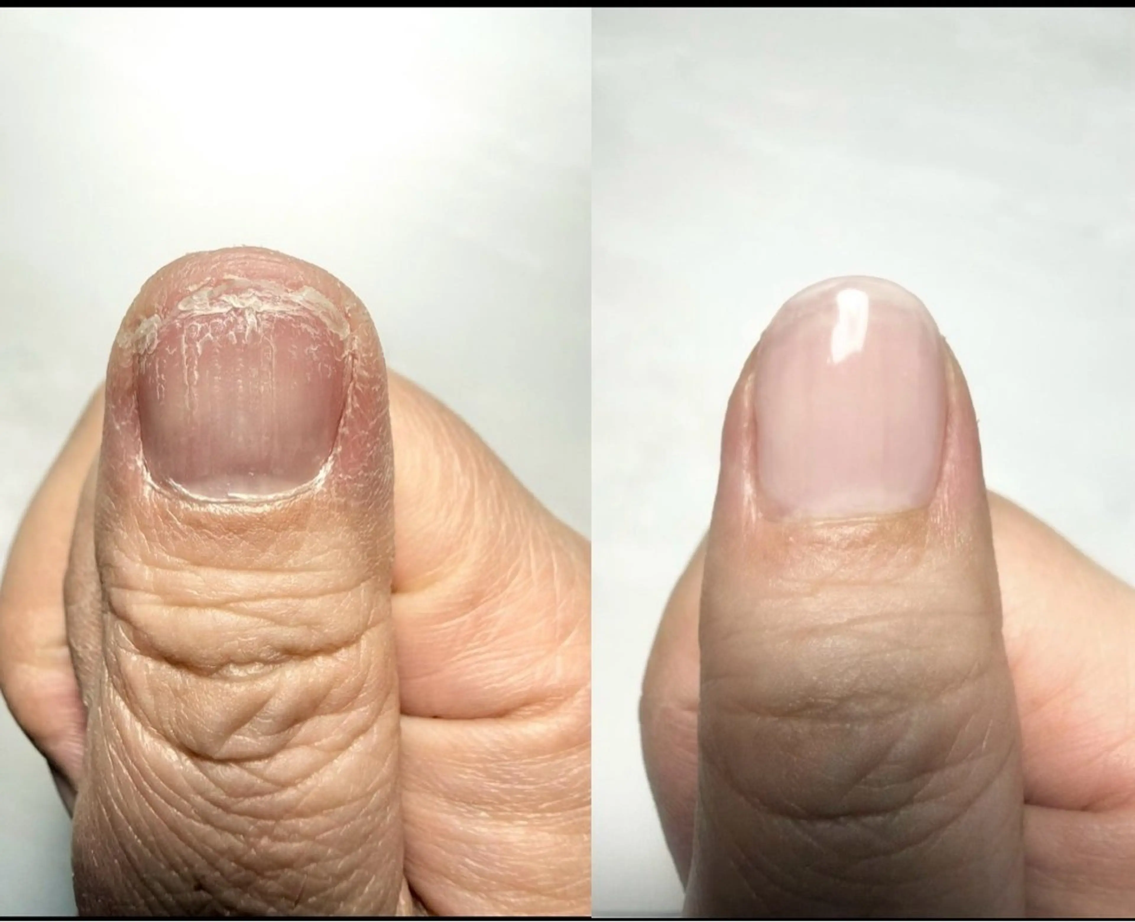 ネイル SORIEN所属・ネイリスト HIROのネイルデザイン