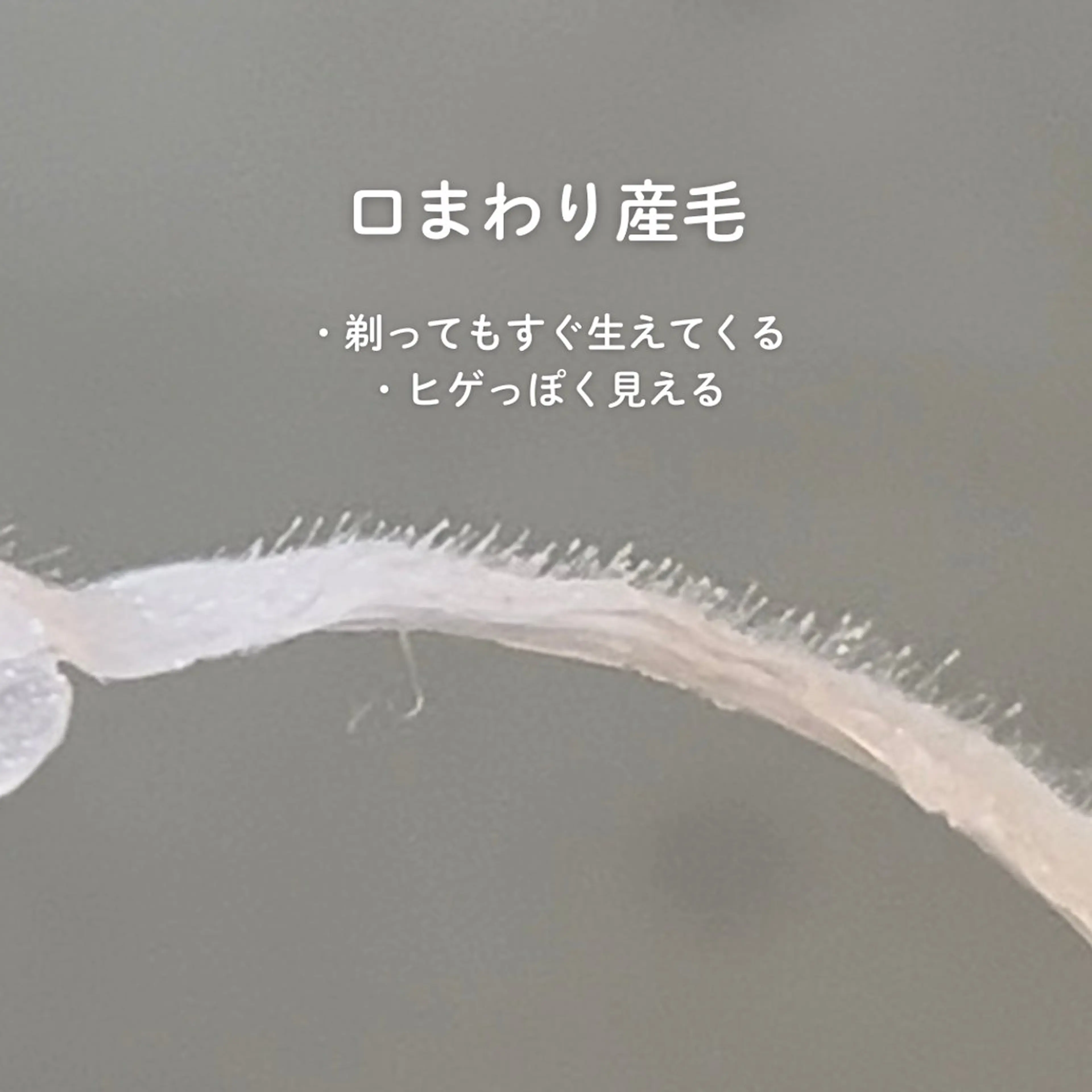 EST BEAUTY所属・顔ワックス脱毛/ ハーブピーリングのエステ・リラクイメージ