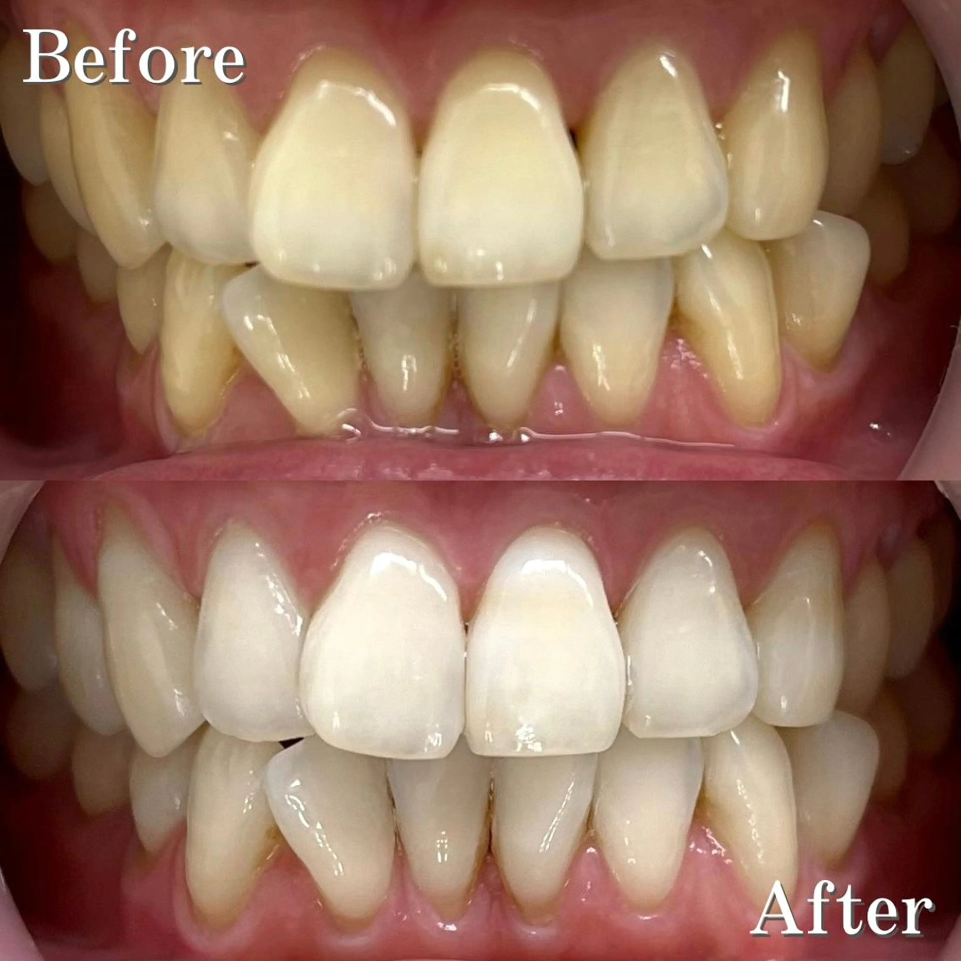 その他 LBSホワイトニング 銀座店💎店長浦和のその他イメージ