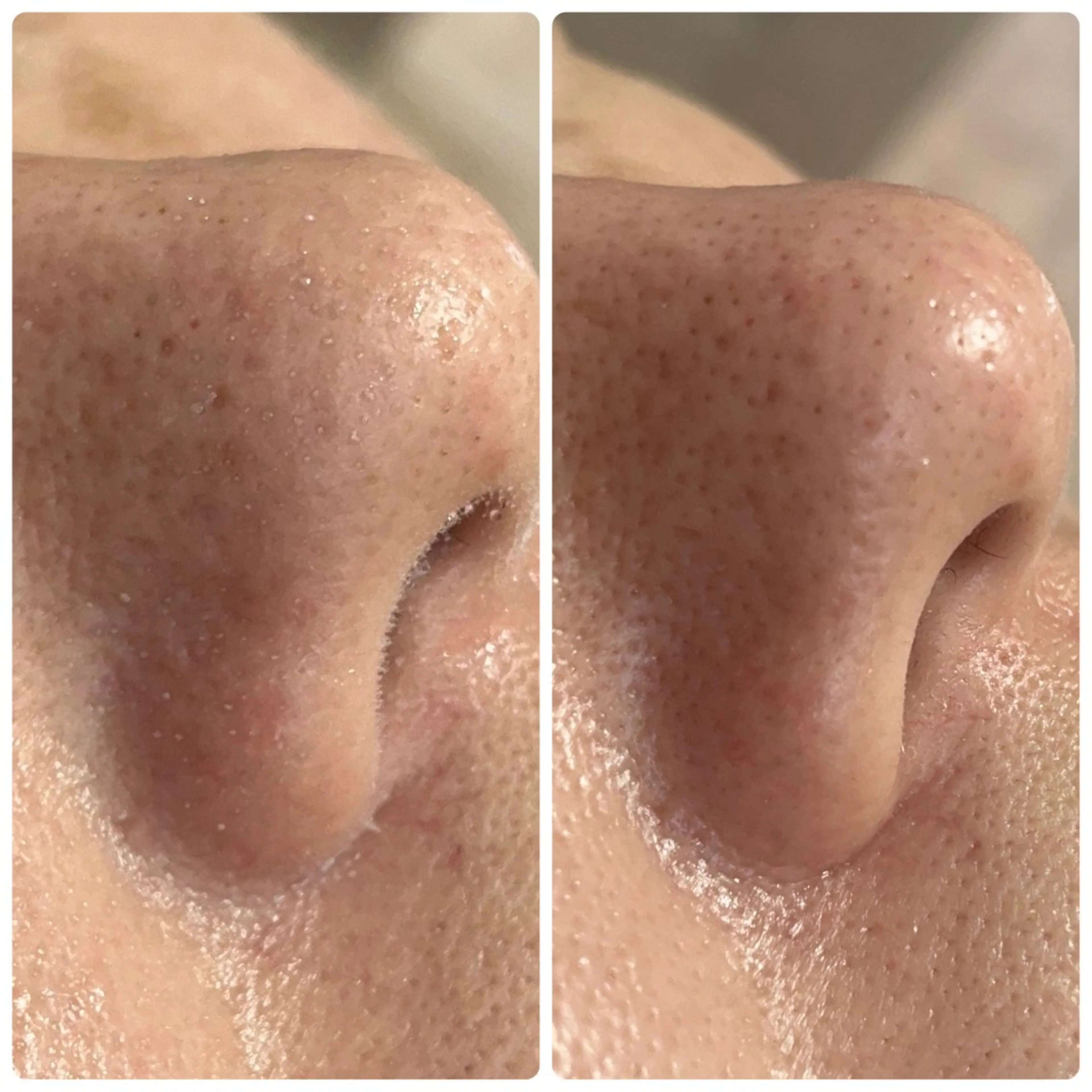 エステ beautysalon  LINO所属・平日昼間限定★ 全メニュ¥6600のエステ・リラクイメージ