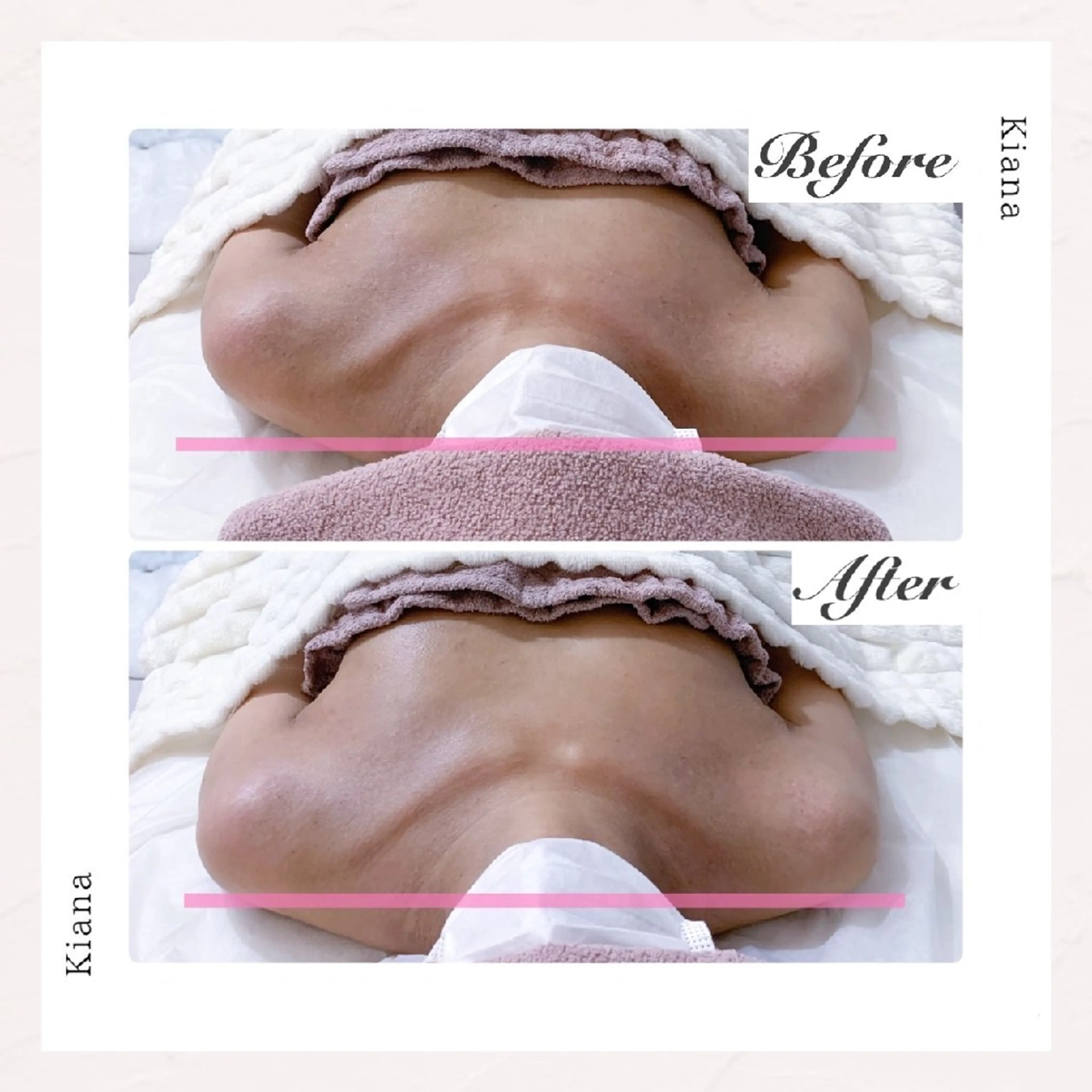 【バスト専門店 】 Kiana のエステ・リラクイメージ