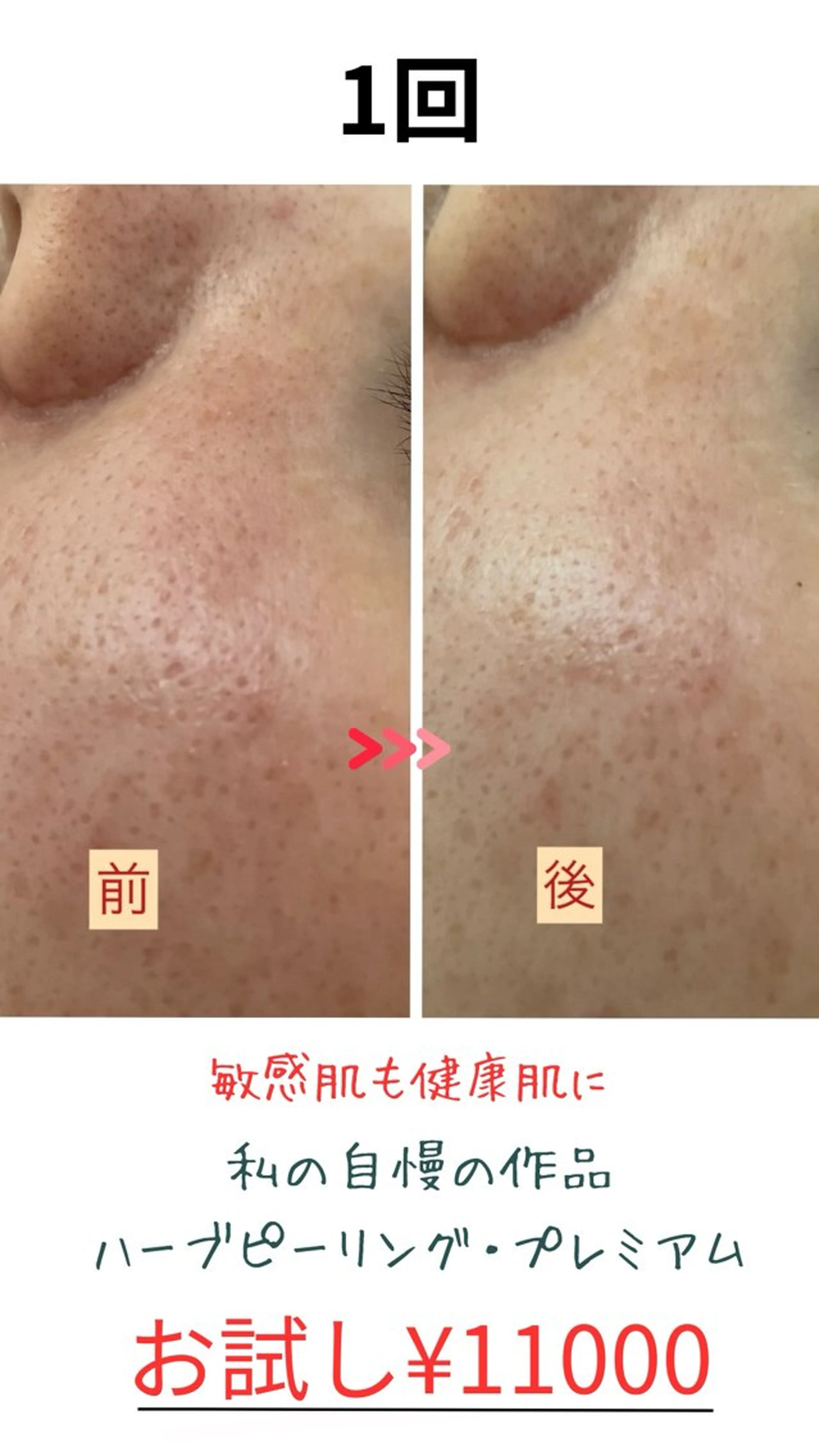 たるみ改善小顔エステ 堀葉月のその他イメージ