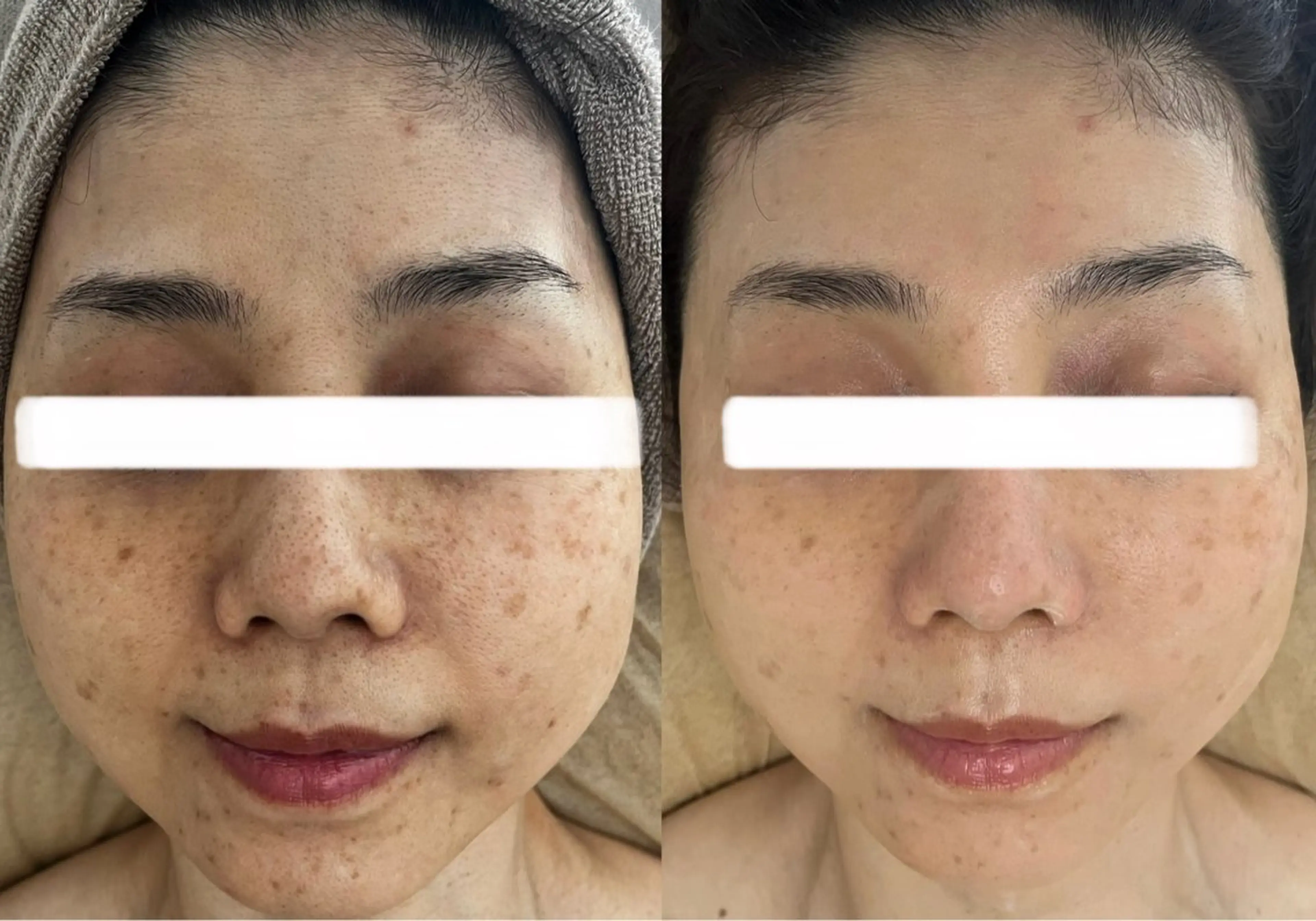 小顔&美肌品川店 Masqueradeのエステ・リラクイメージ