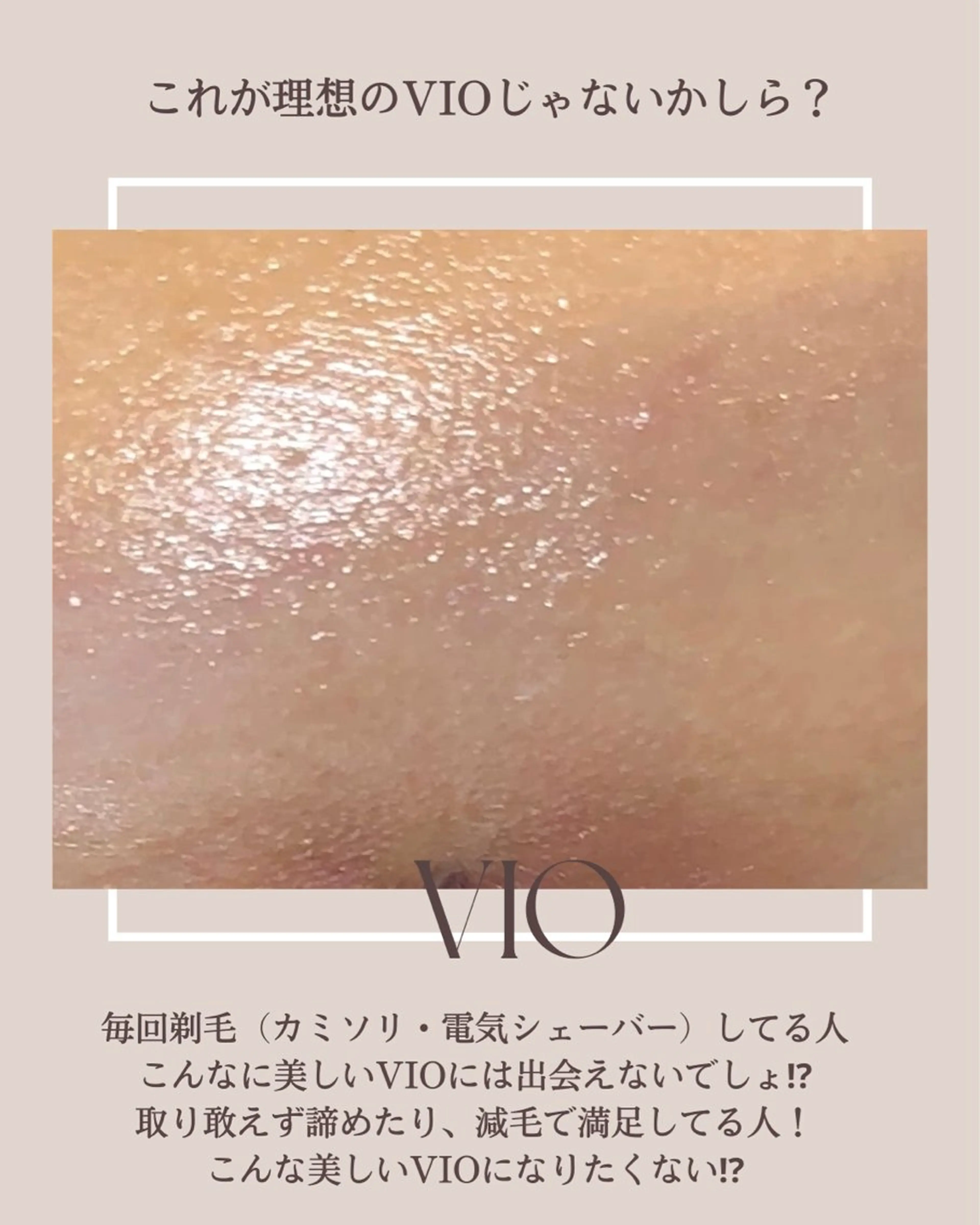 Hit. シュガーリング豊橋のエステ・リラクイメージ