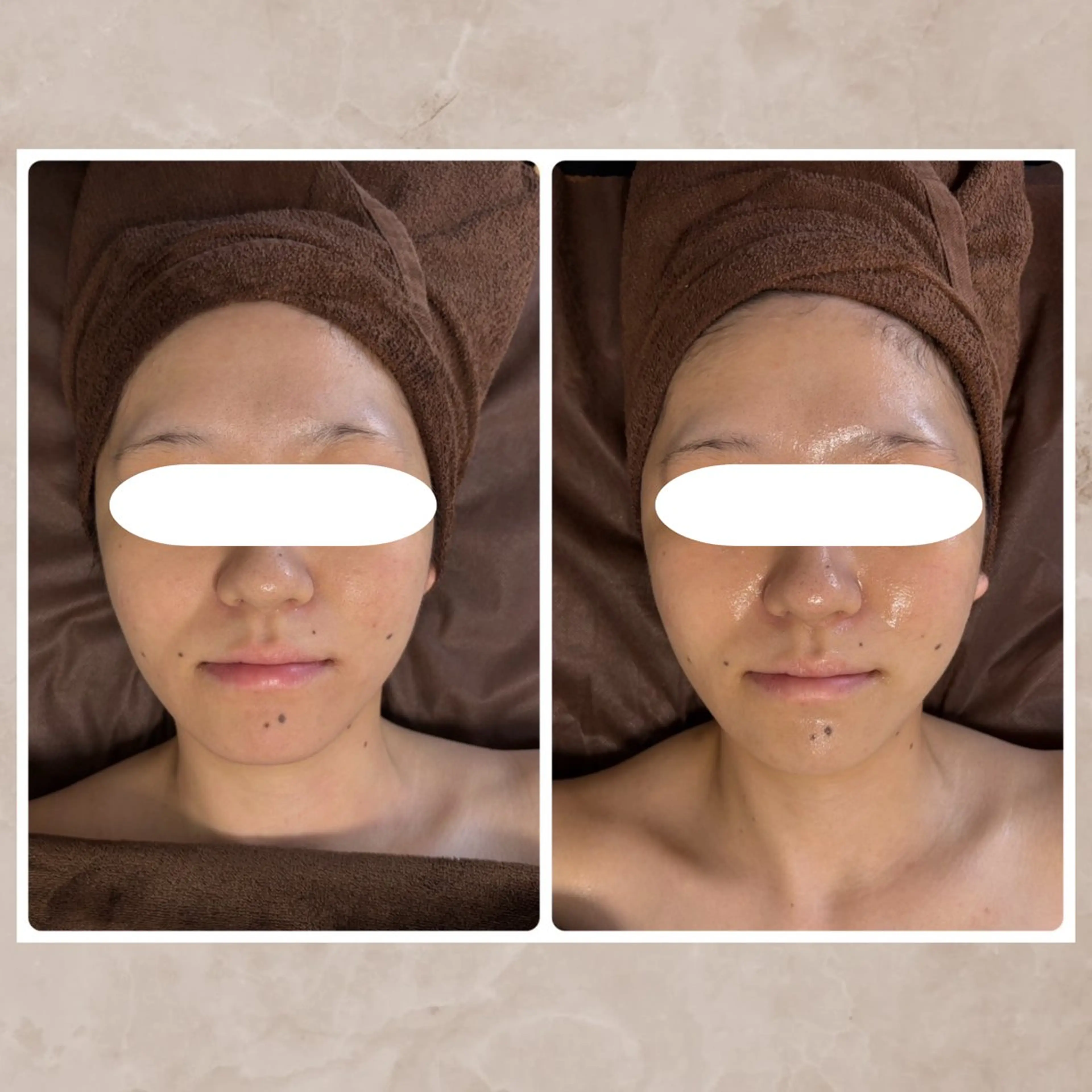 エステ リラク Total Beauty Salon Vi's CLUB by BINEL所属・Vi's CLUB KOTONOのエステ・リラクイメージ