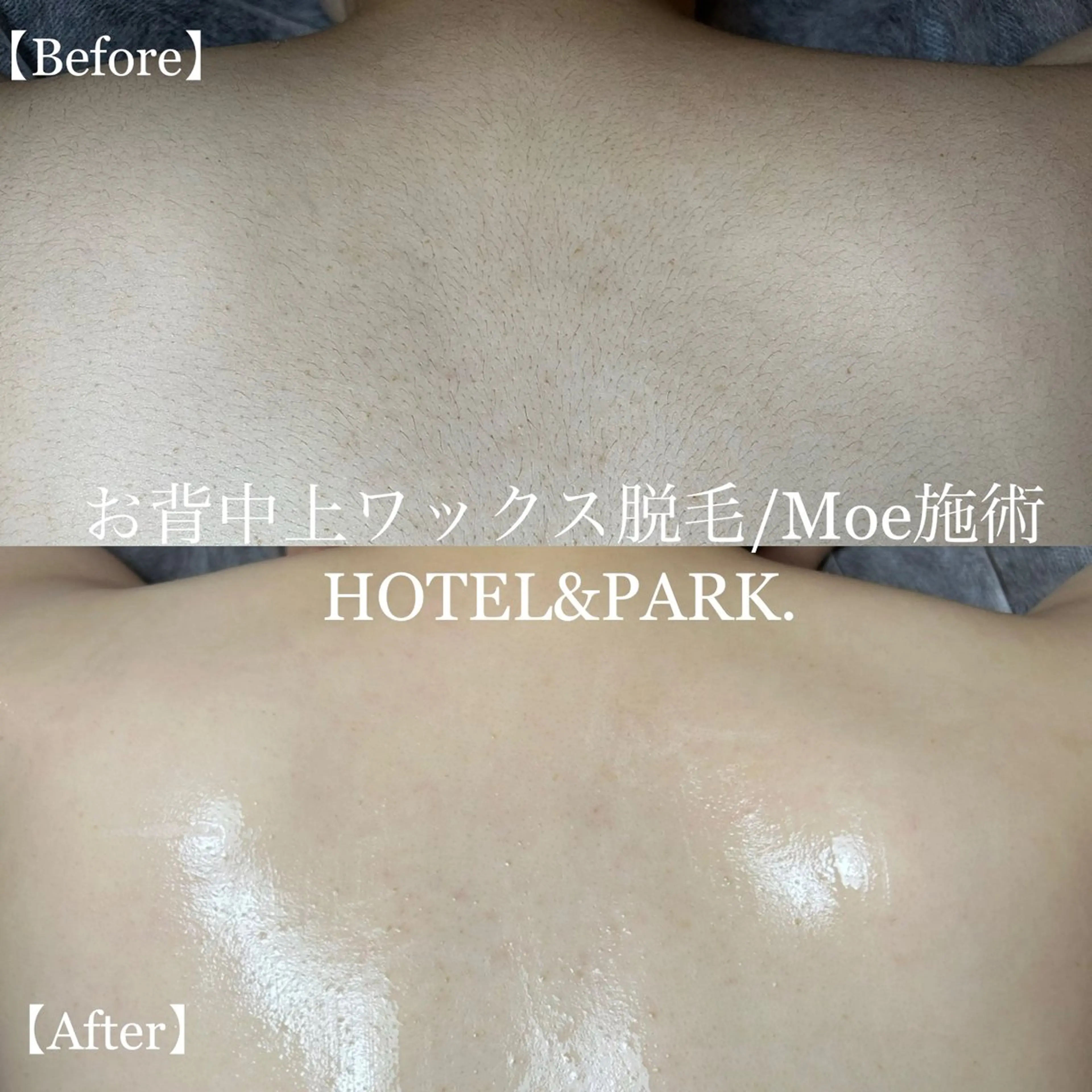 HOTEL&PARK .Moeワックス脱毛のエステ・リラクイメージ