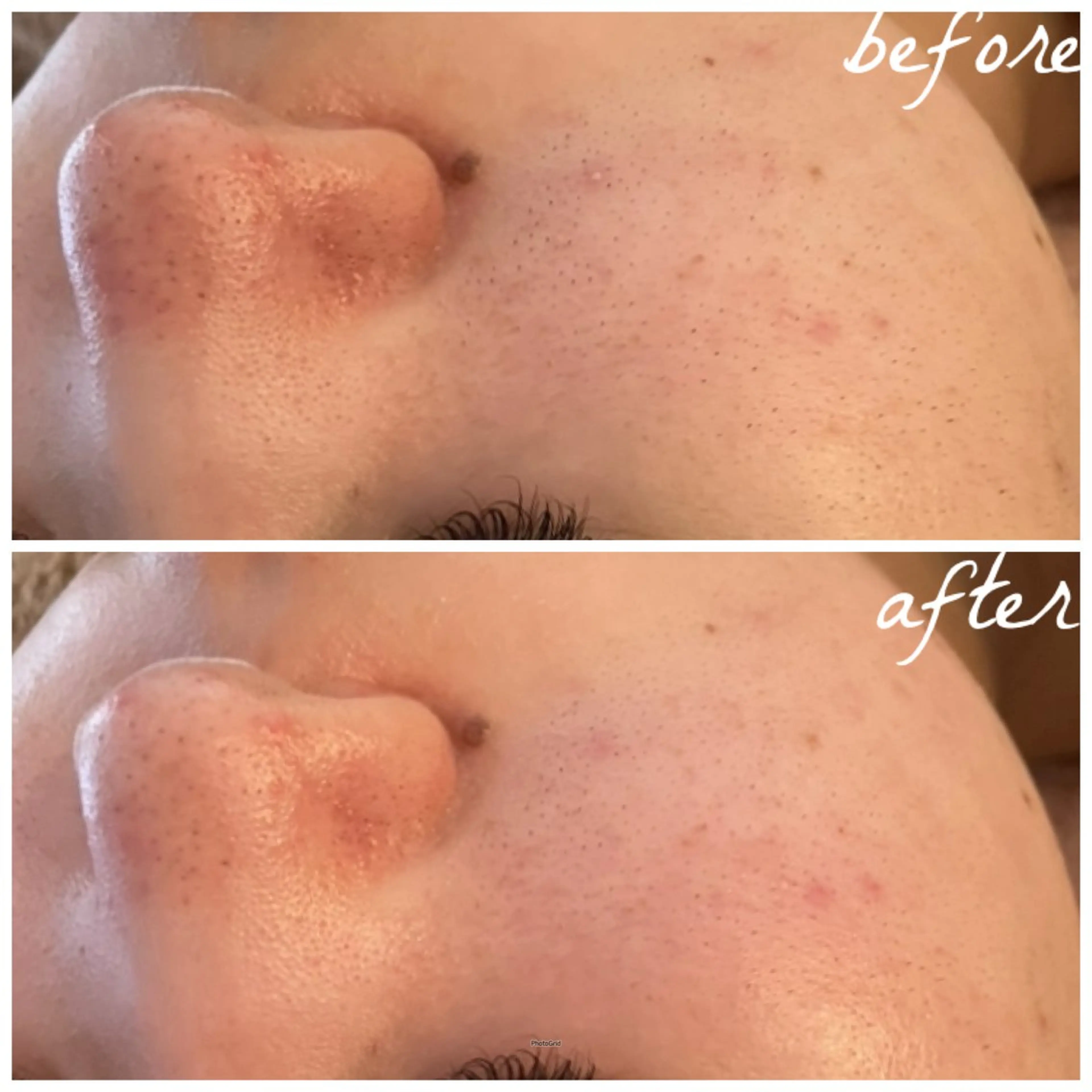 メンズ エステ メナード岐阜茜部 杉浦のエステ・リラクイメージ