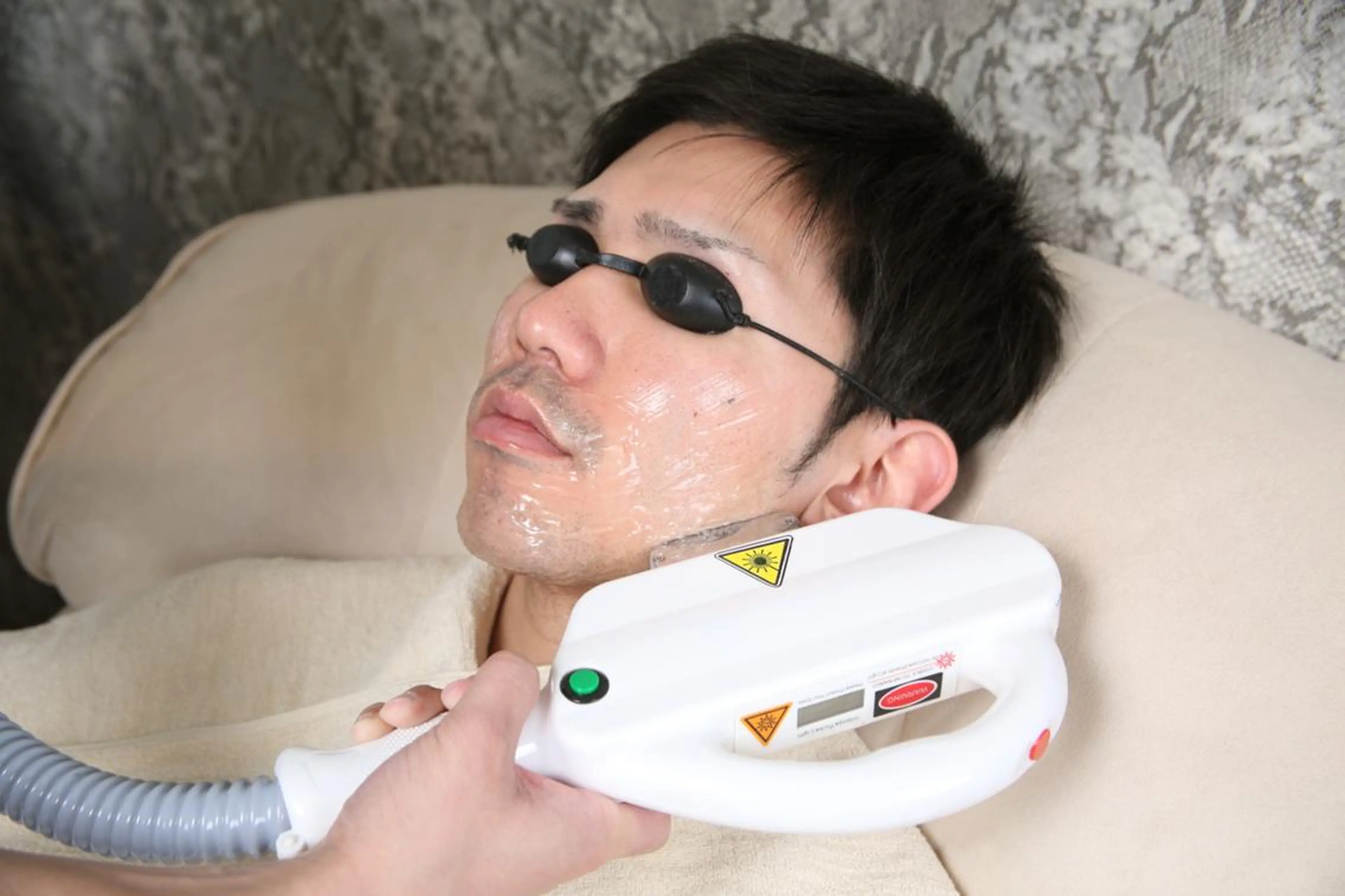 【青ヒゲ/カミソリ負け/赤み/脱シェービング】ヒゲ脱毛全面  ¥11880⇒¥4500の写真