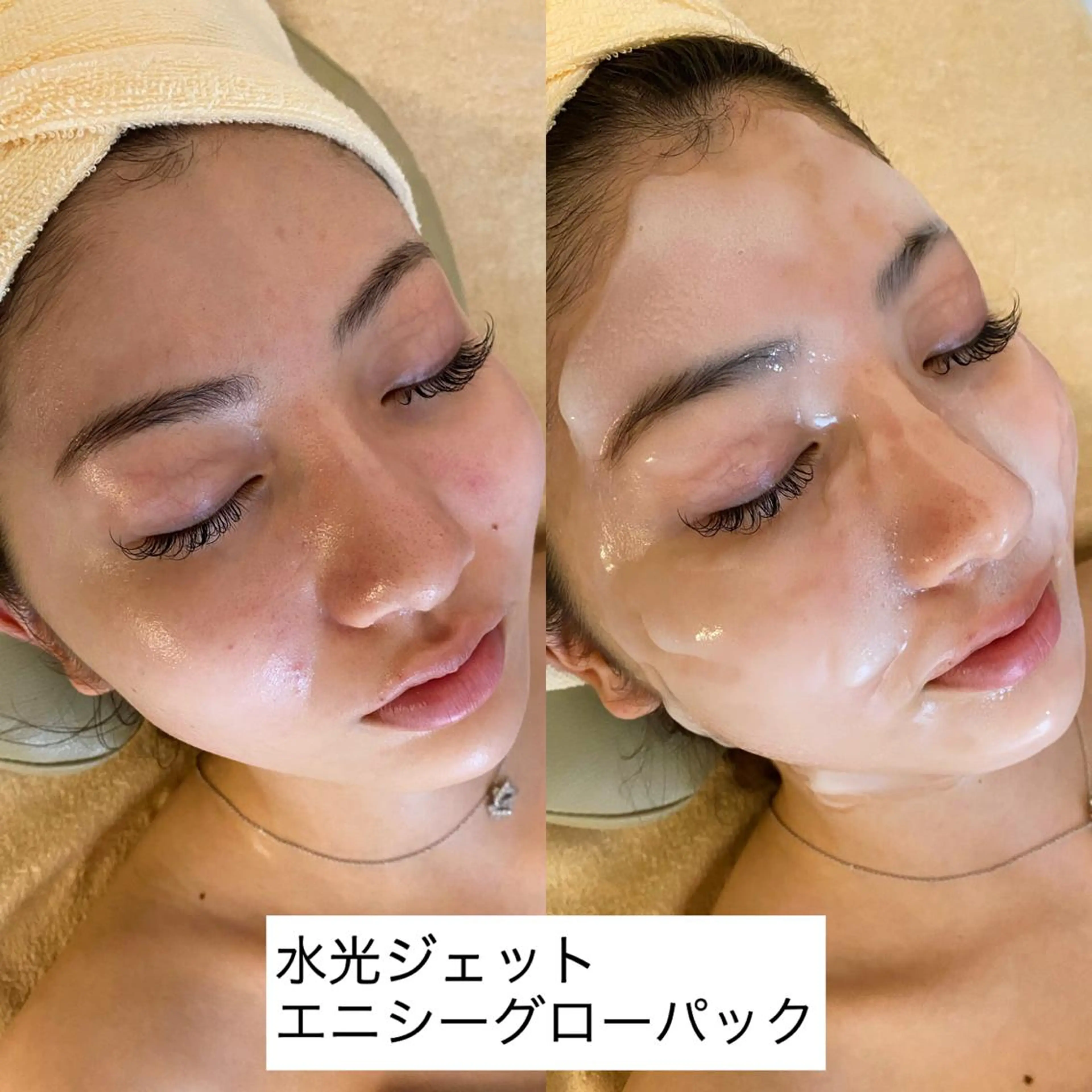 エステ うなじ脱毛/美肌脱毛 LABELのエステ・リラクイメージ