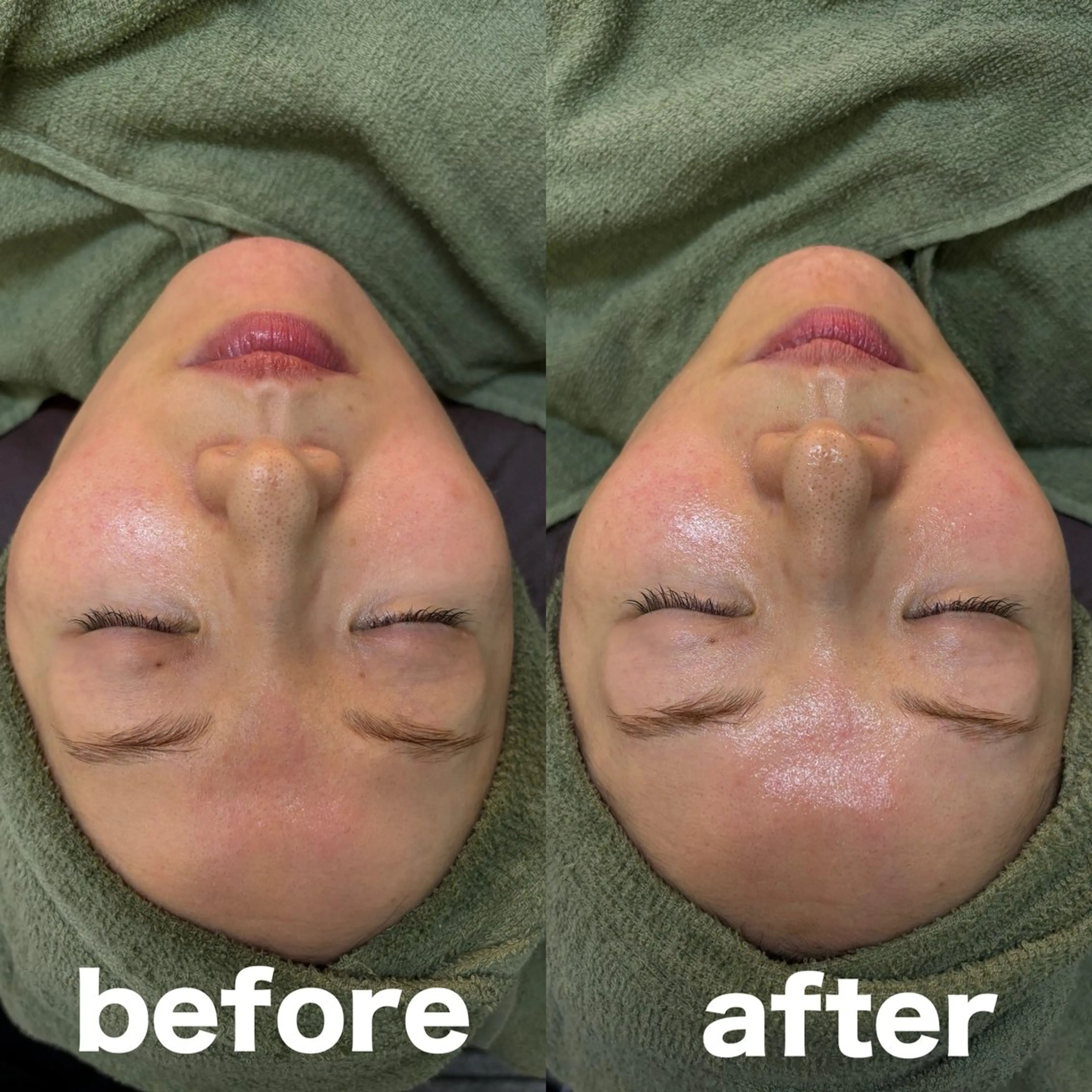 エステ 肌質改善 陶器肌🌿のエステ・リラクイメージ