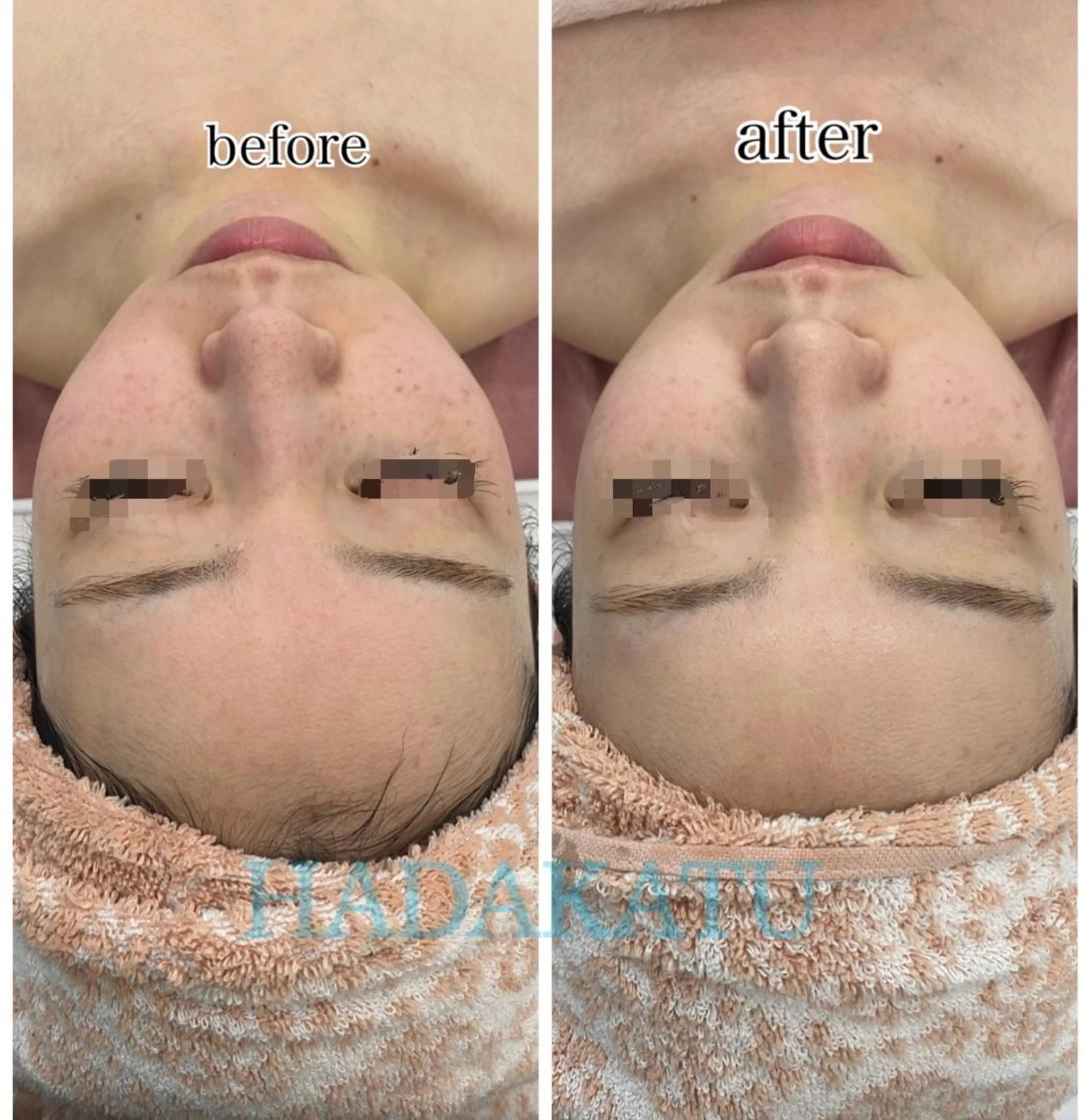 総合エステサロン 肌活のエステ・リラクイメージ