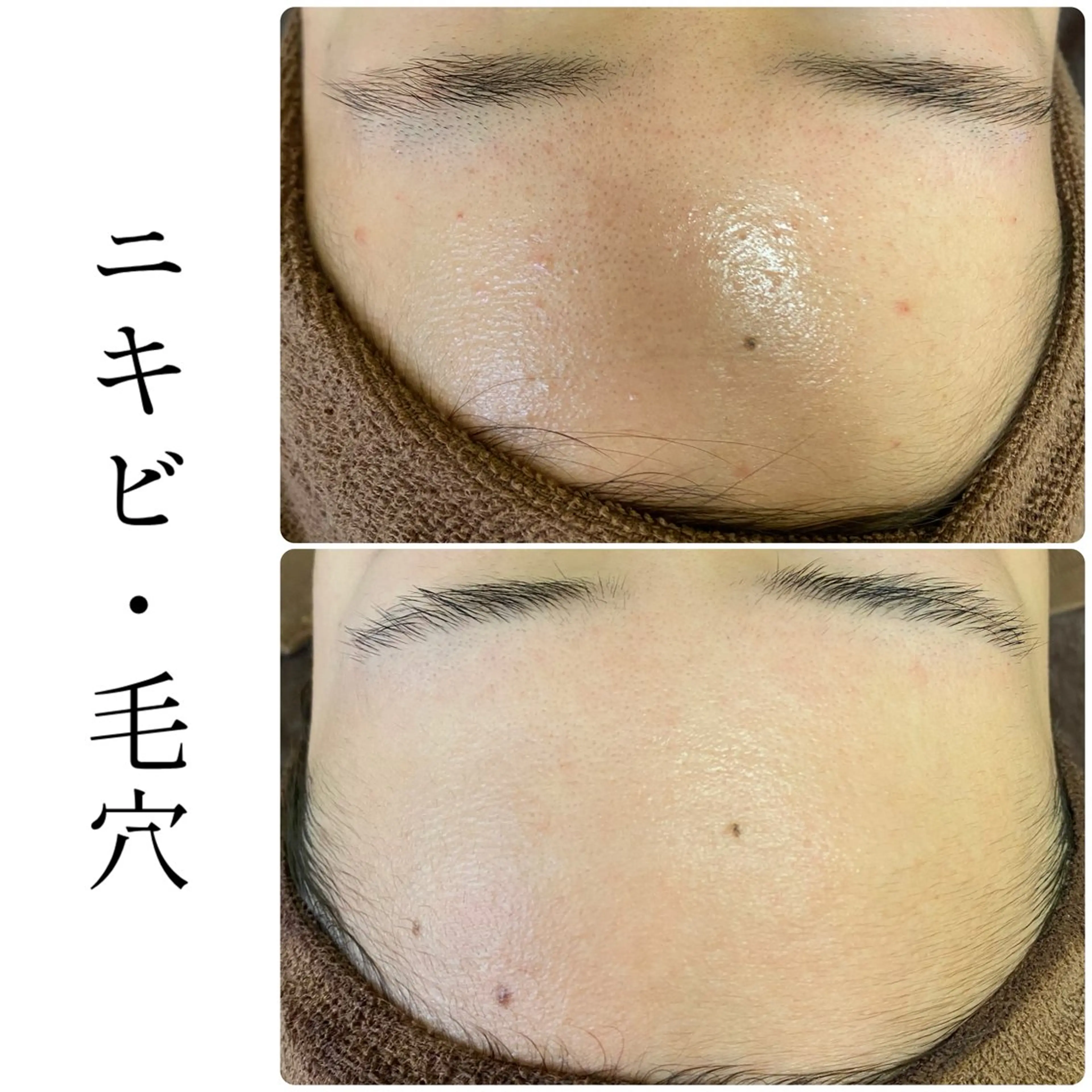 エステ ハーブピーリング専門 BIOEL横浜のエステ・リラクイメージ