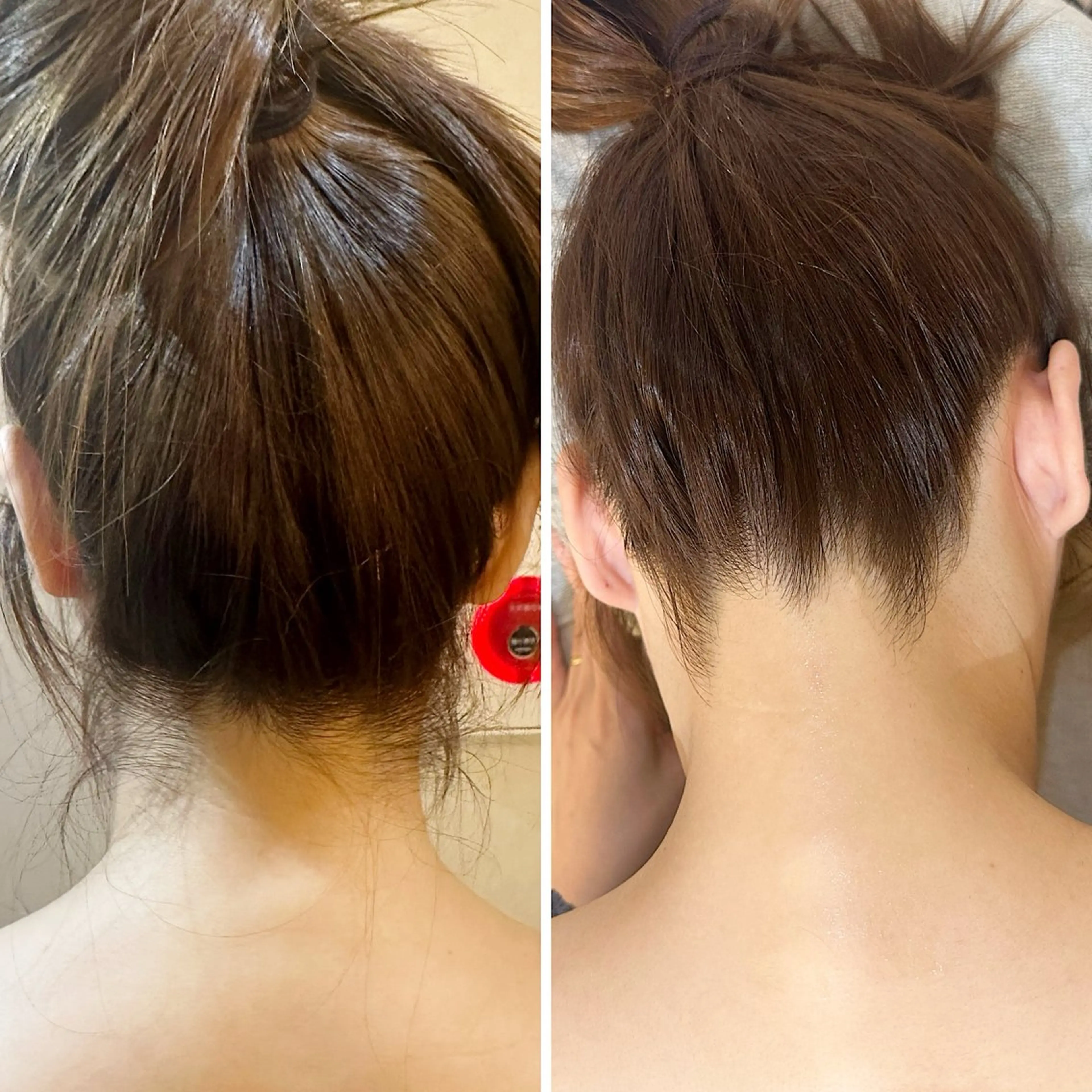 脱毛 うなじ脱毛/美肌脱毛 LABELのエステ・リラクイメージ