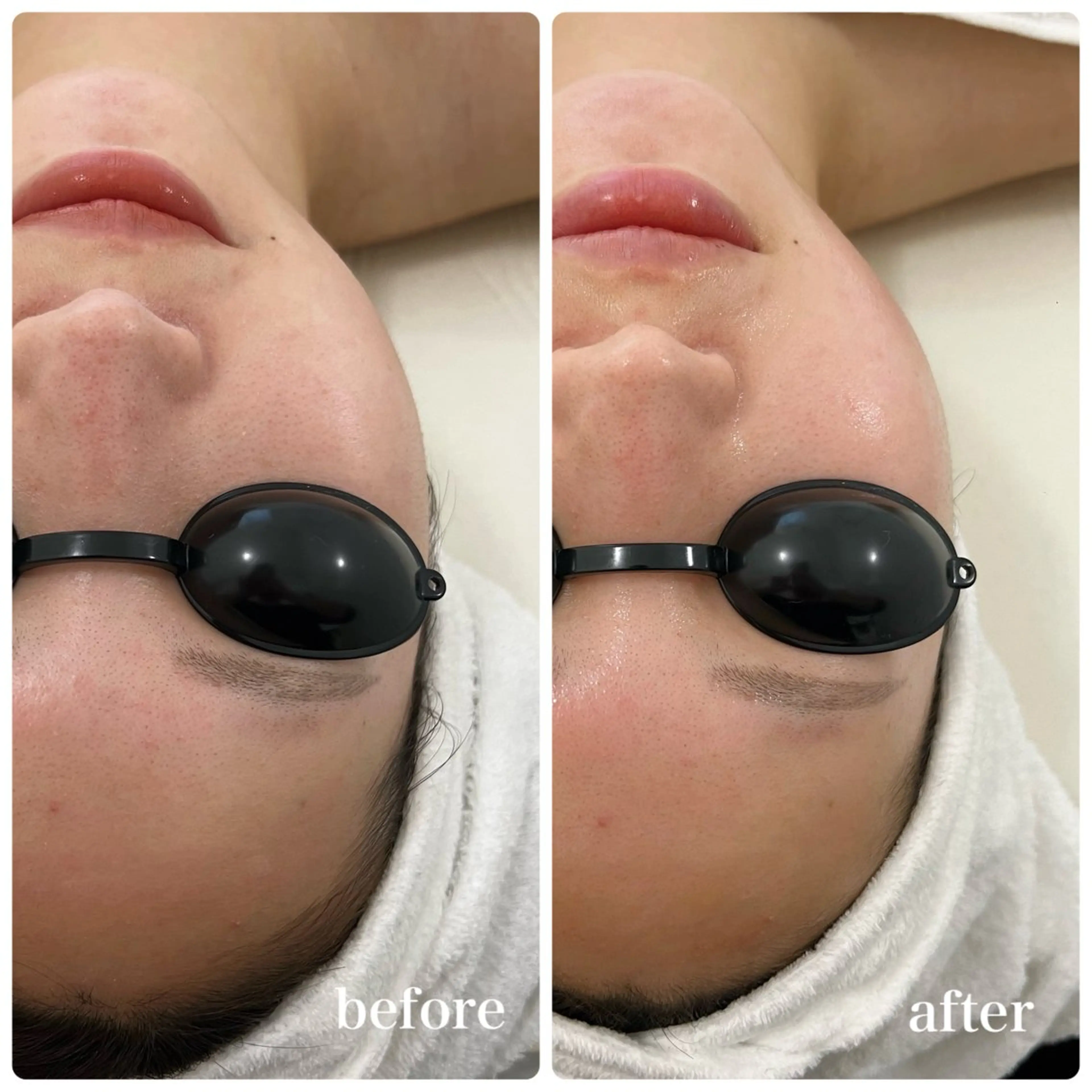 Liam《美肌管理/ 3D小顔/脂肪ケア》のエステ・リラクイメージ