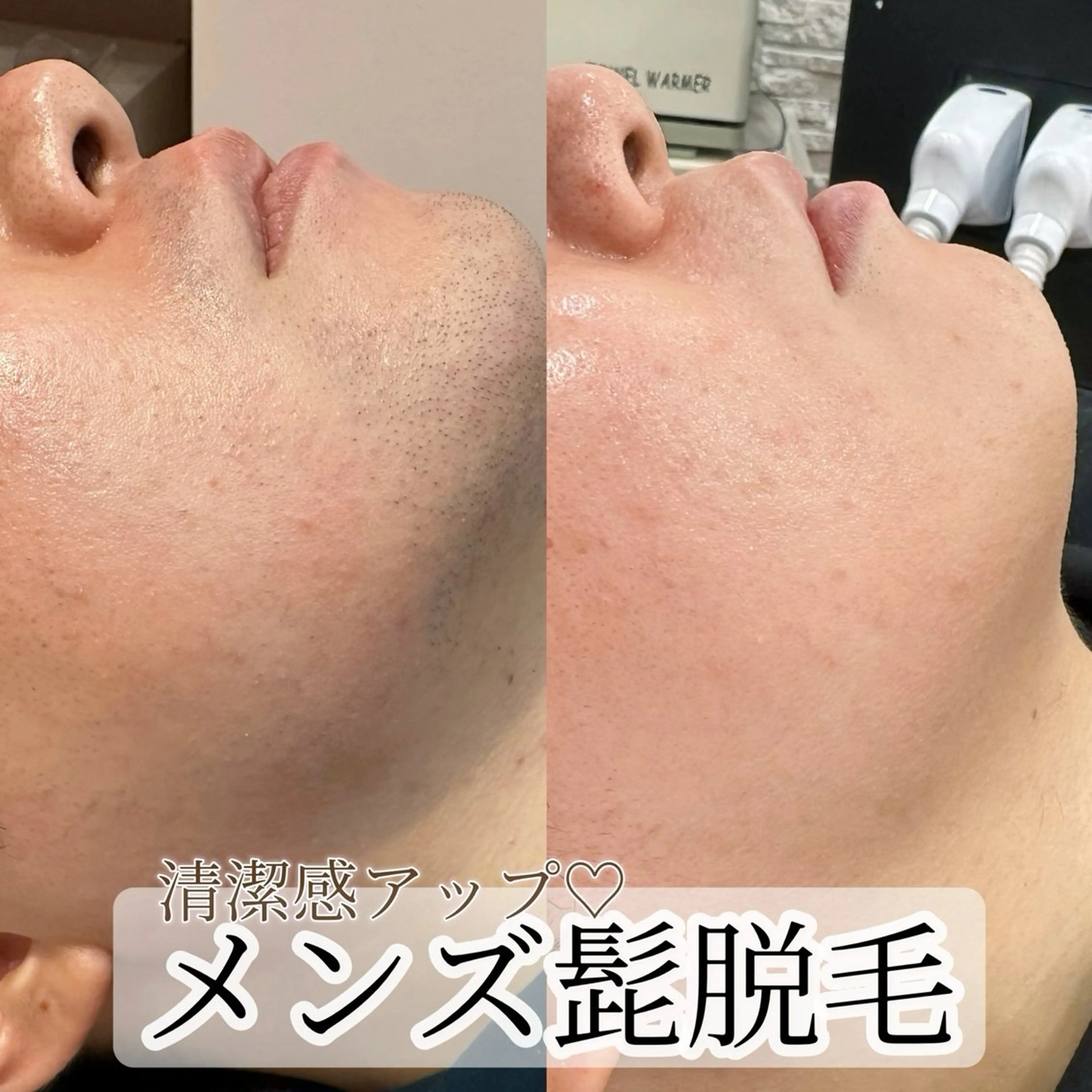 脱毛 Amaryllis 🌹のエステ・リラクイメージ