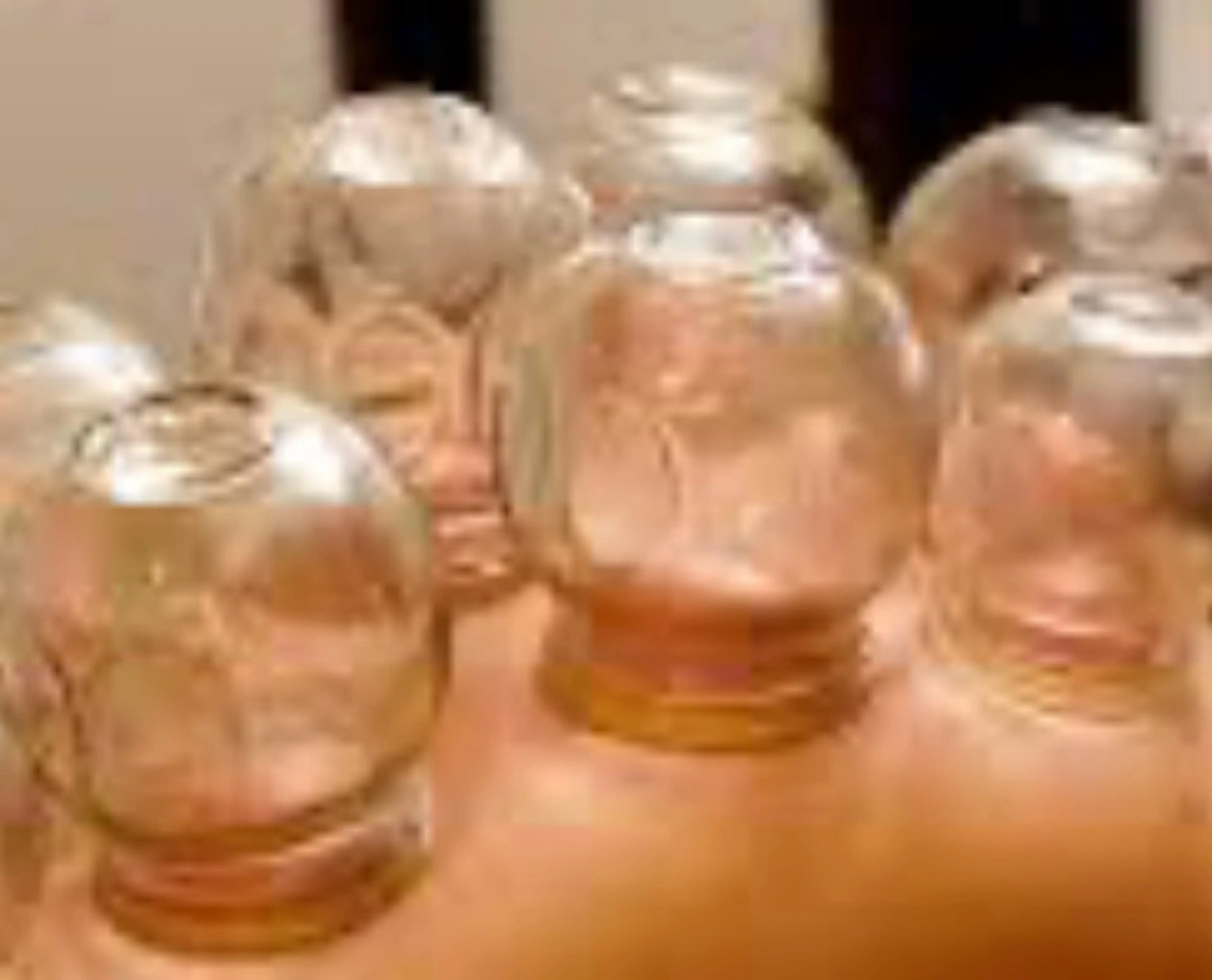 メンズ 美容電気脱毛/アロママッサージ&フェイシャルGiulio《ジュリオ》所属・脱毛/フェイシャル Giulioジュリオのエステ・リラクイメージ