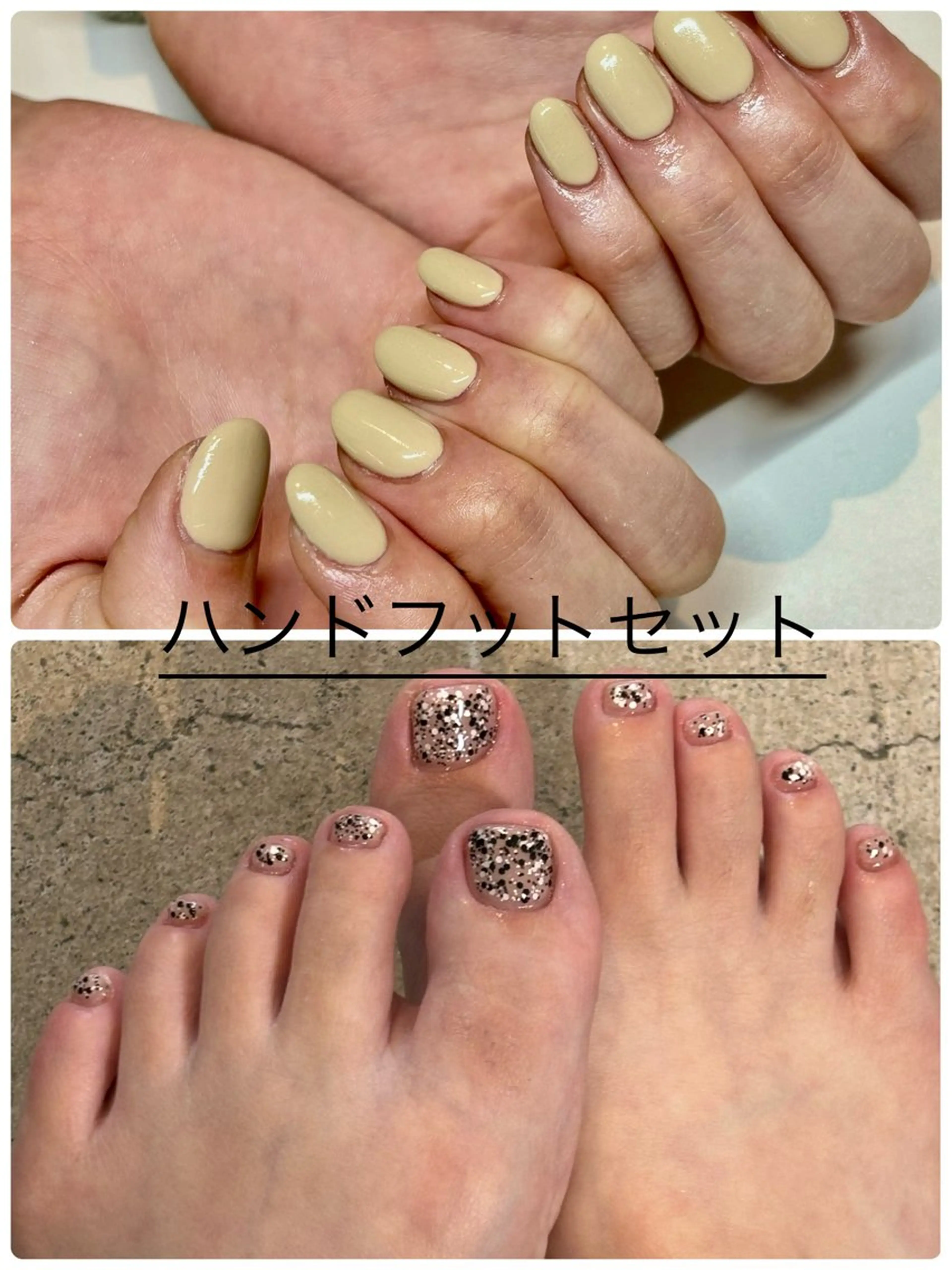 ワンカラーハンド&フットセット9000円！の写真