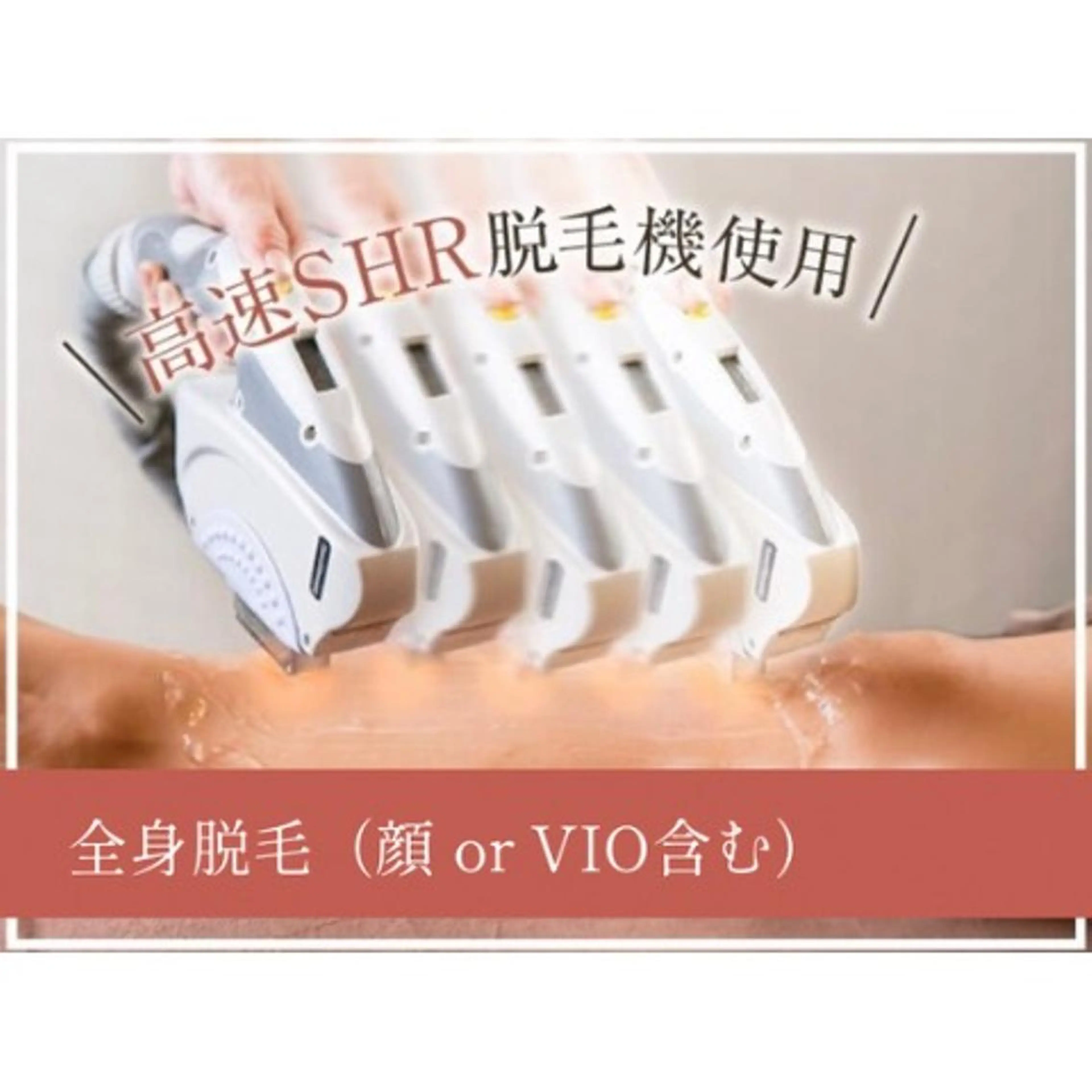 【 全身＋顔 or VIO脱毛】SHR高速脱毛の写真