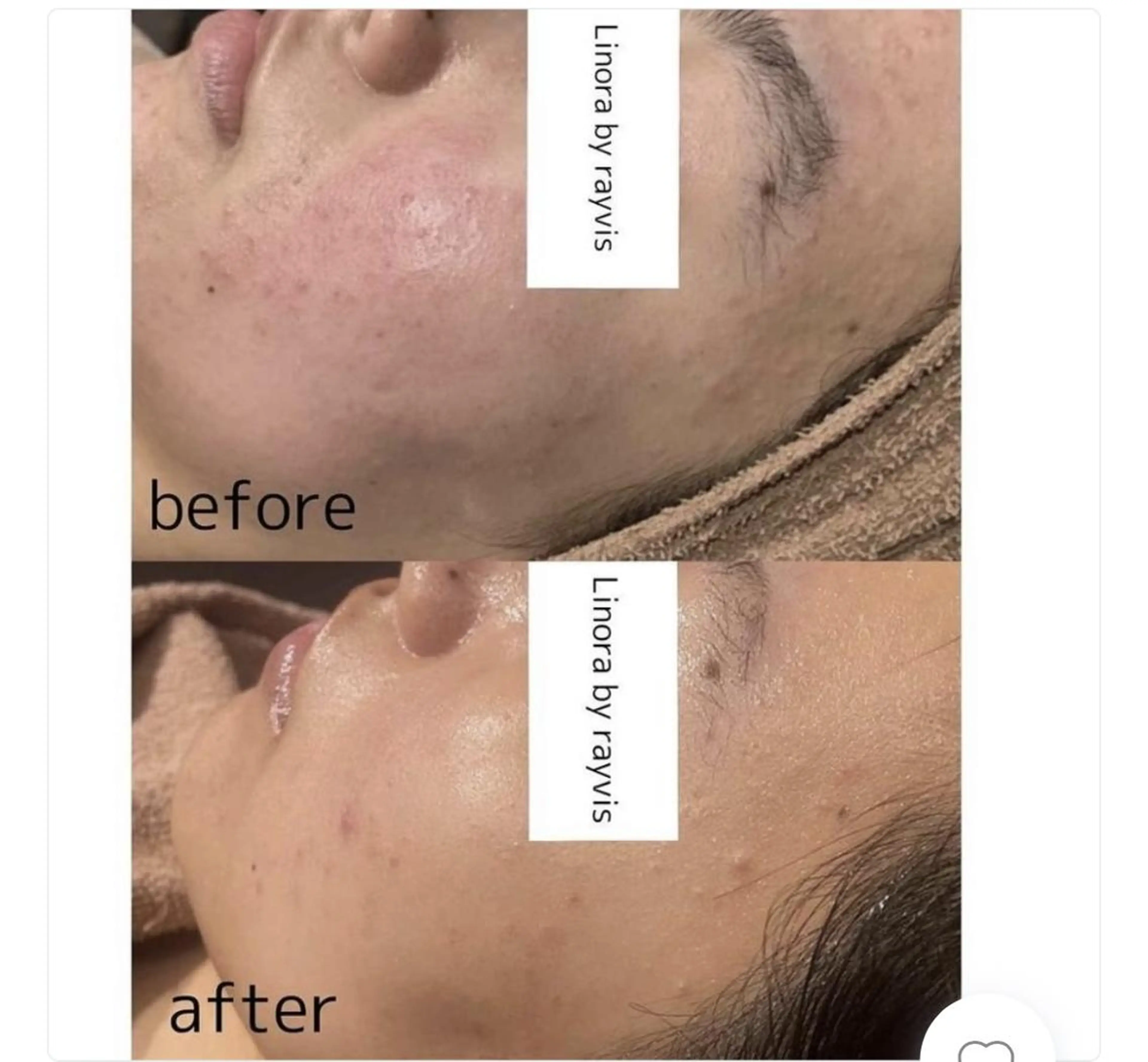 エステ 🌈Linora byRAYVIS🌈のエステ・リラクイメージ