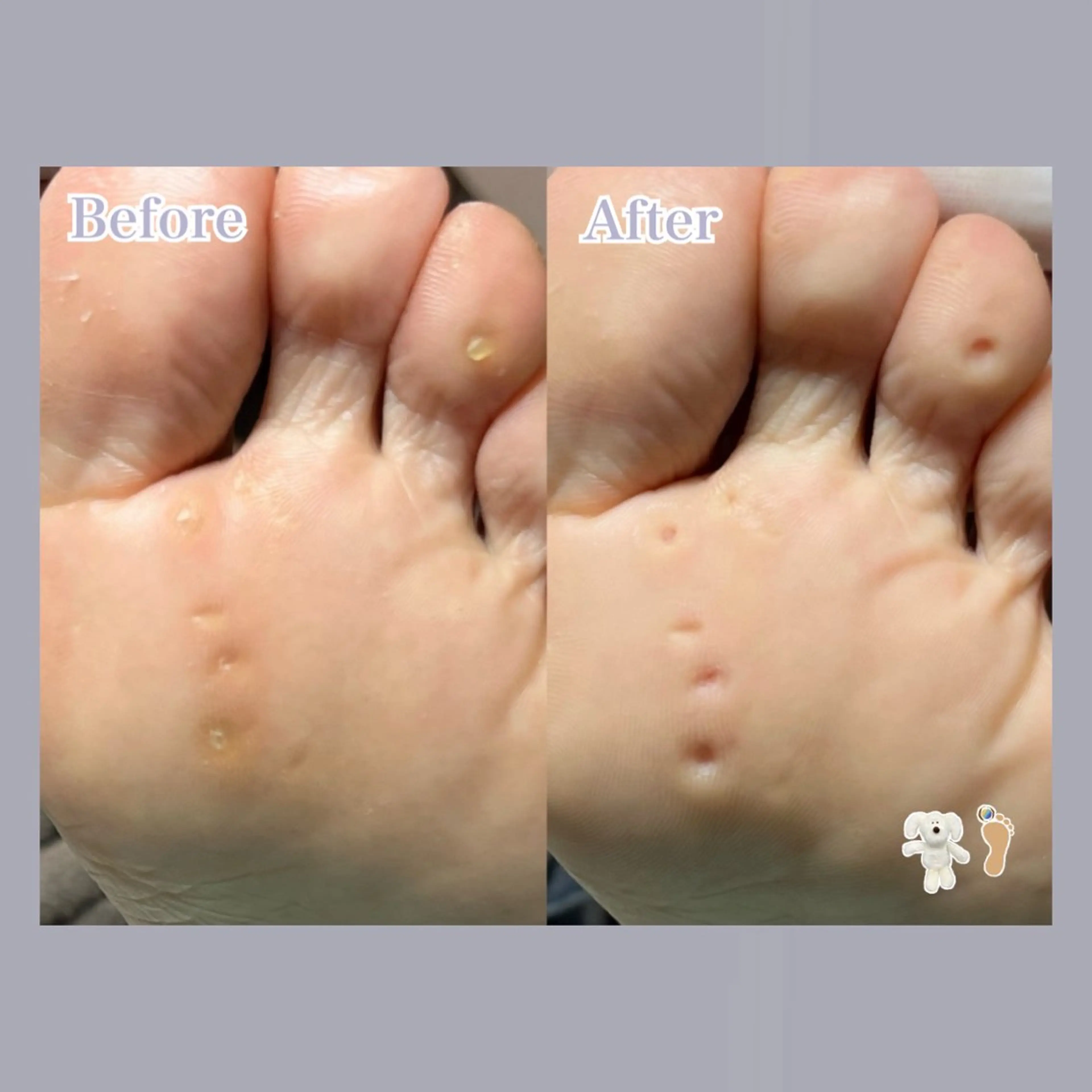 巻き爪補正店 大阪天王寺店のネイルデザイン