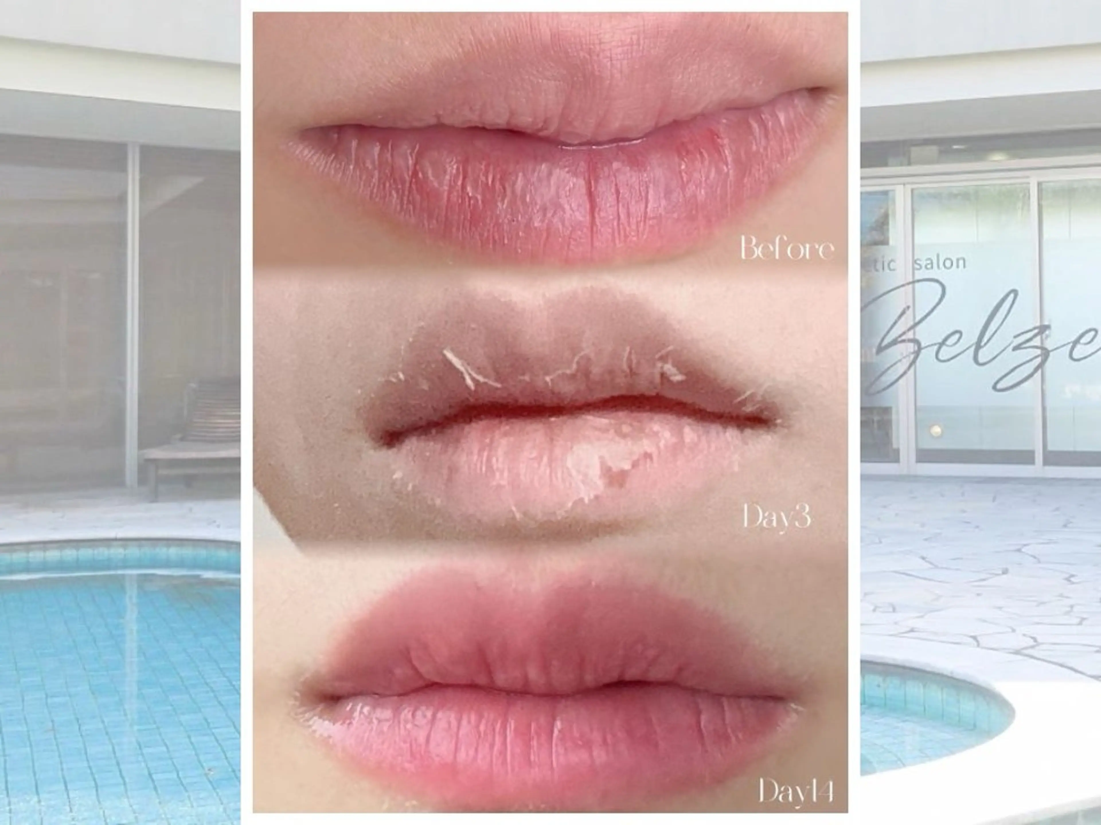 【ローマピンク🩷無料カウンセリング】の写真