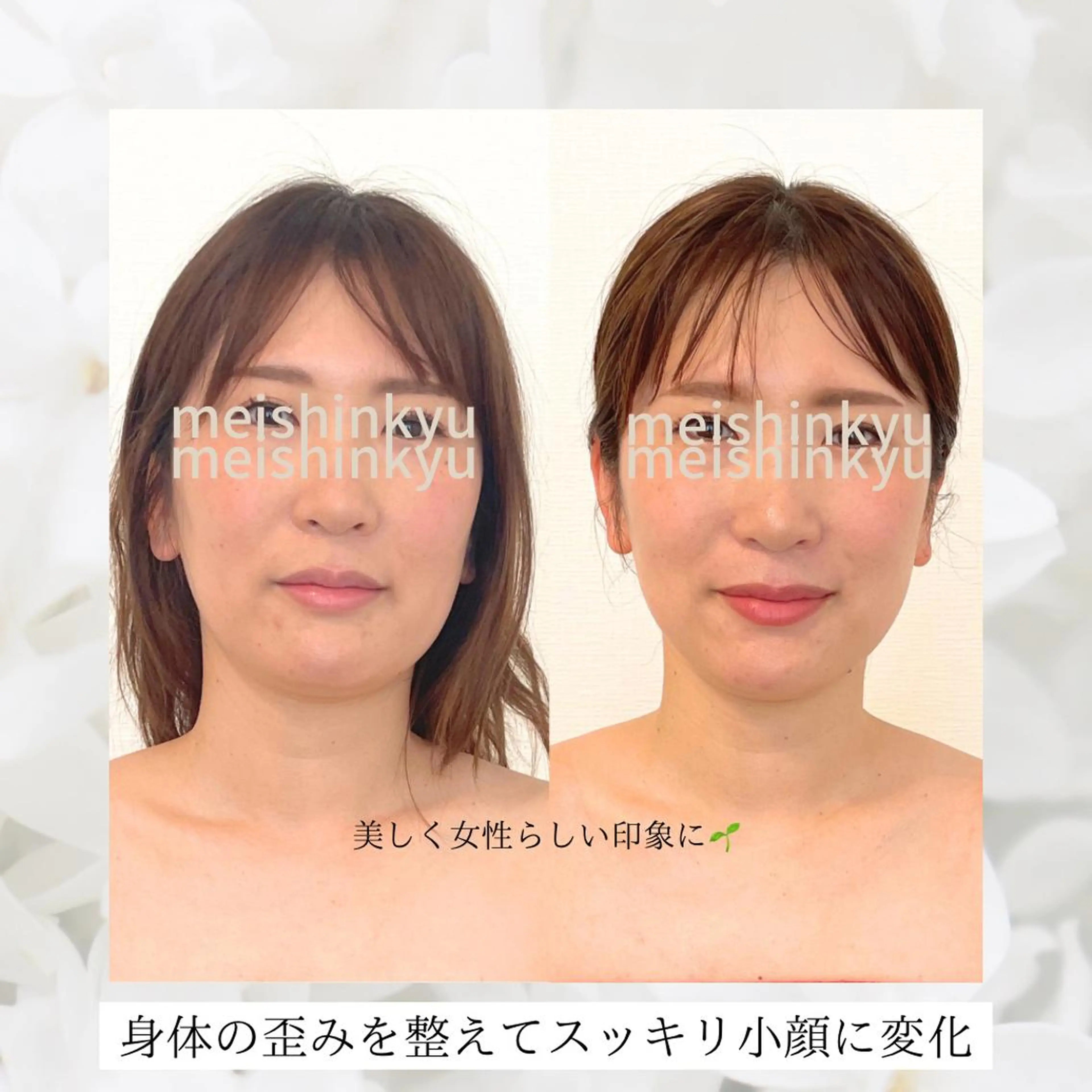 meishinkyu所属・小顔矯正  小林 香織のエステ・リラクイメージ