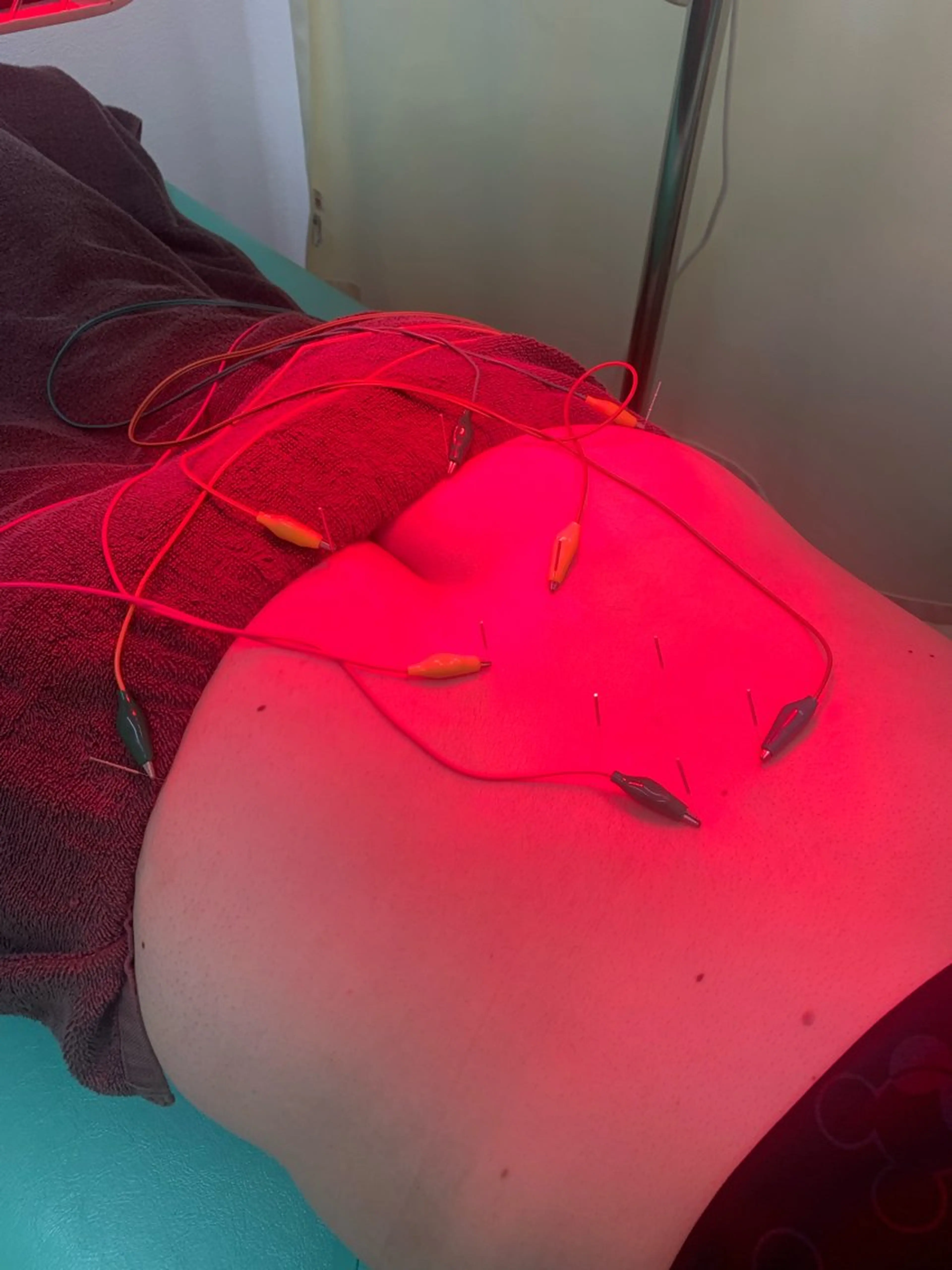 リラク 河輪 鍼灸接骨院のエステ・リラクイメージ