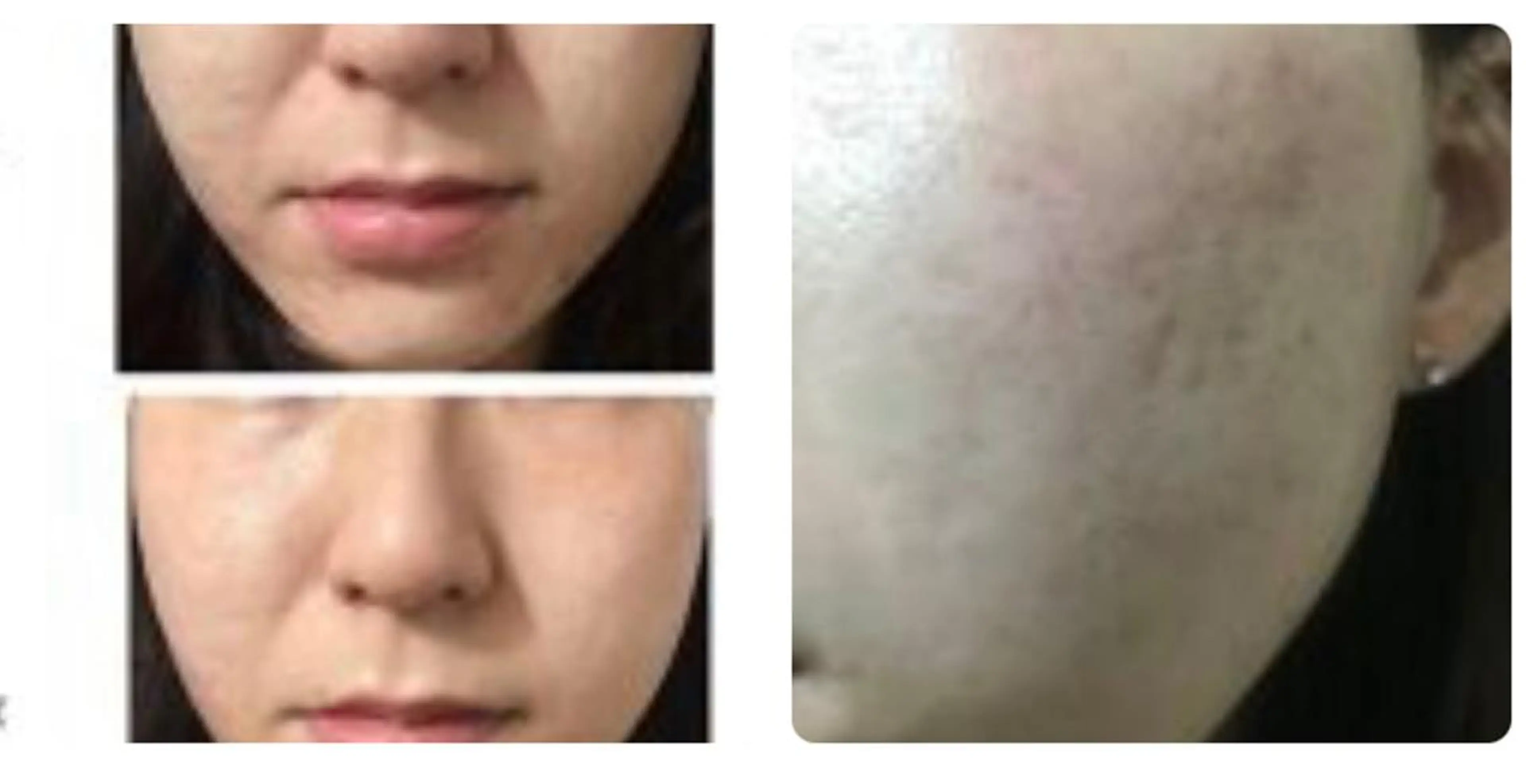 viage所属・南野 曜子のエステ・リラクイメージ