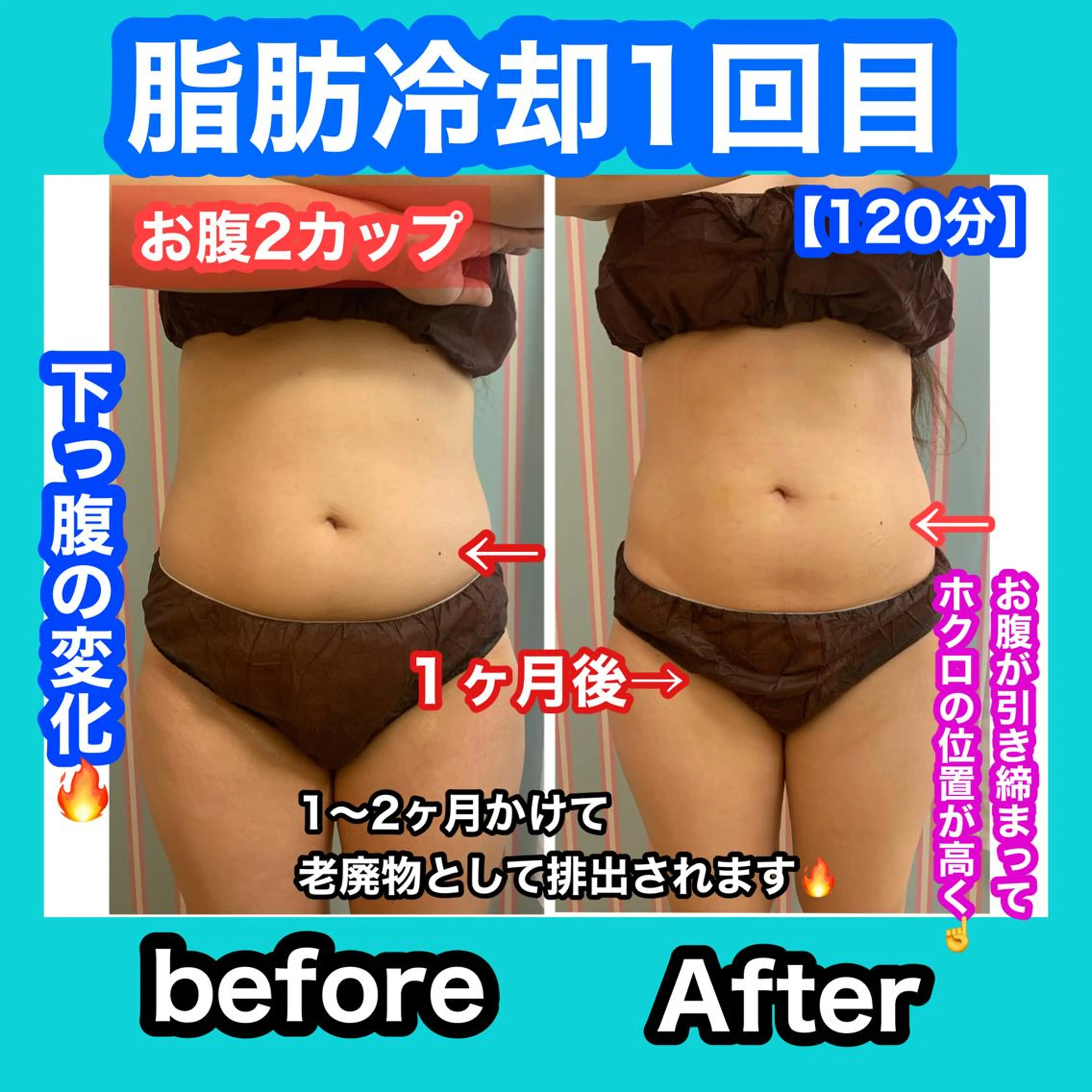 エステ 痩身/脱毛/ネイル HARUKAのエステ・リラクイメージ