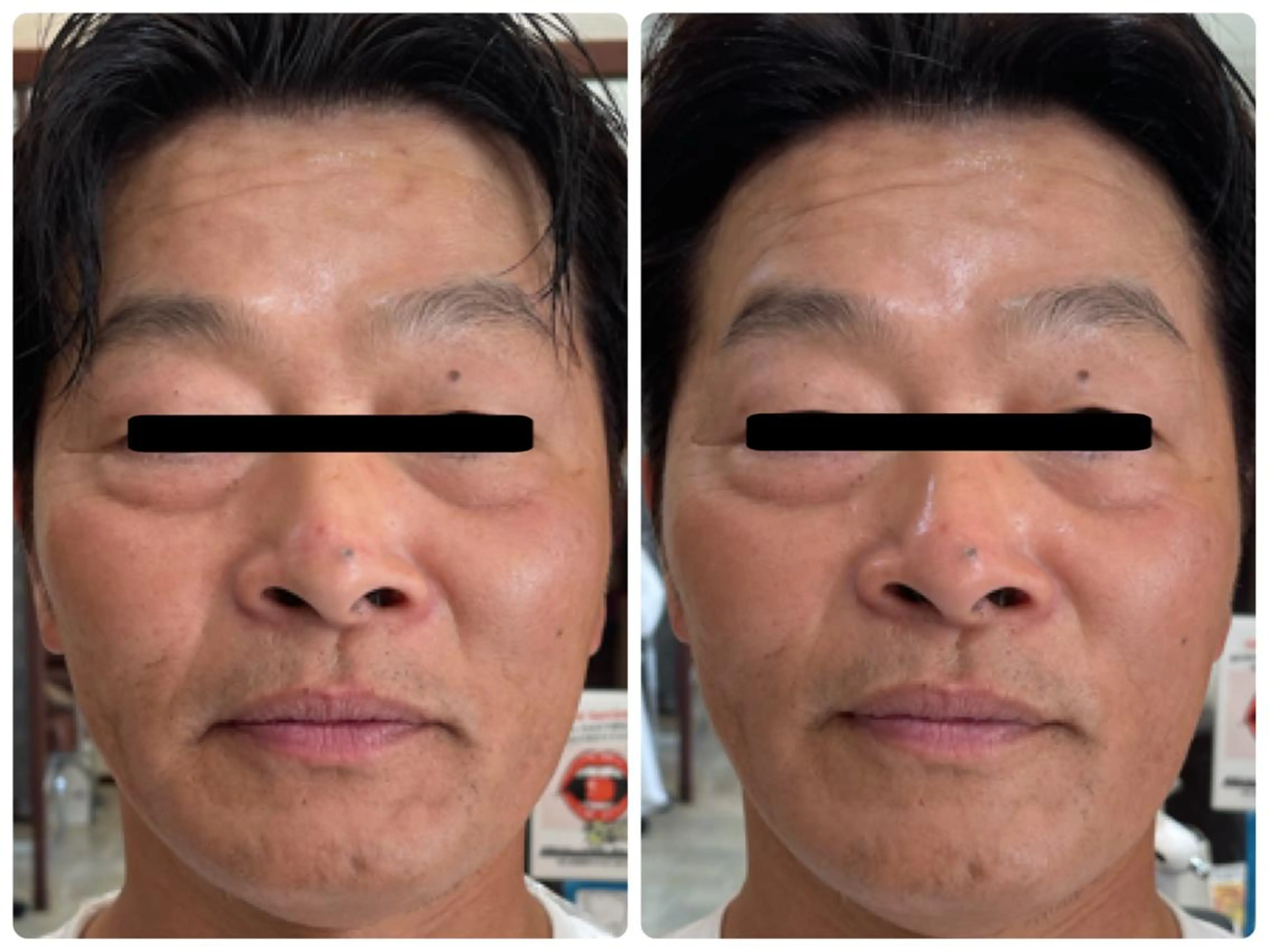 Eyelash Salon 4Uのマツエク・マツパデザイン