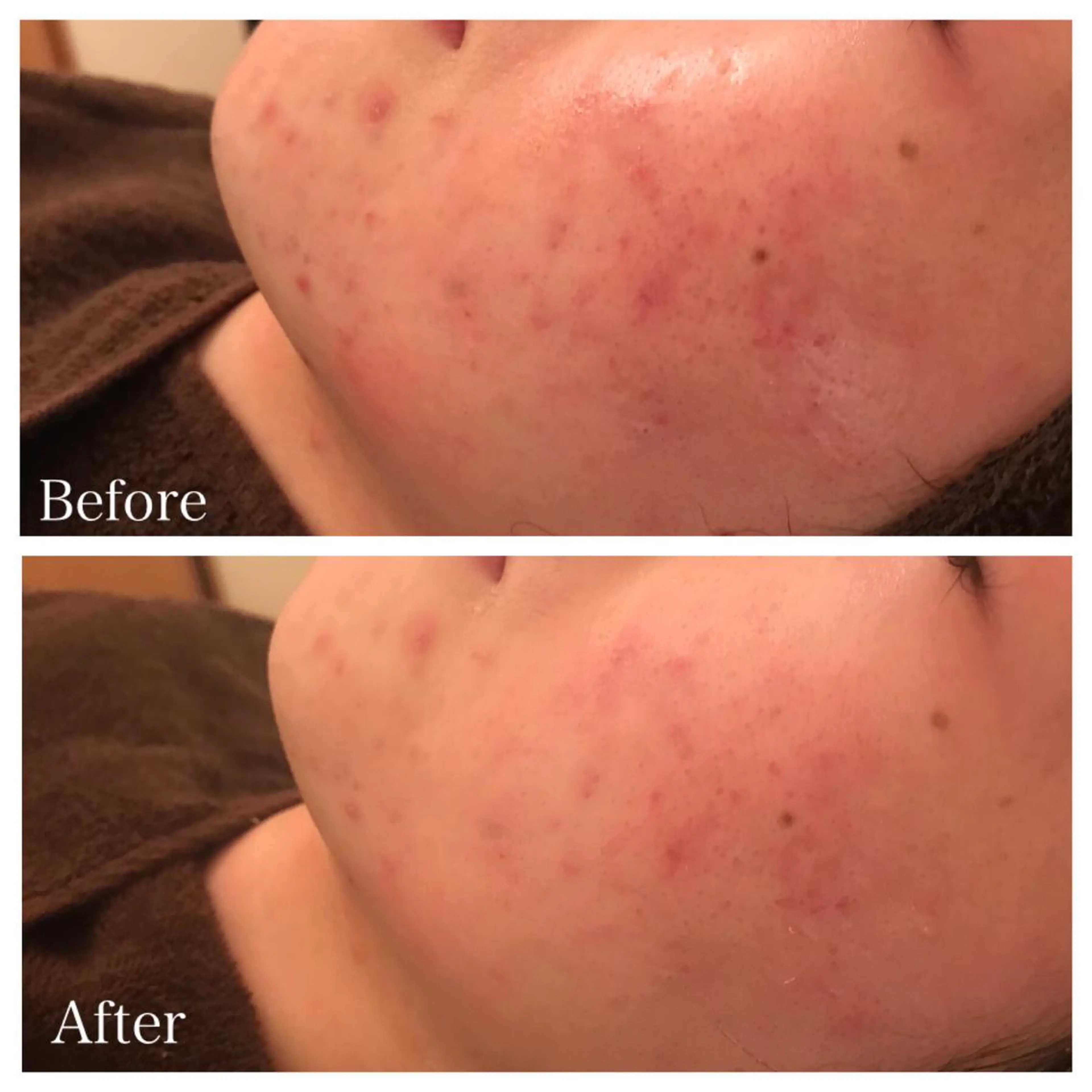 セミロング ネイル マツエク・マツパ エステ リラク ニキビ跡専門サロン Ａｉｎａのエステ・リラクイメージ