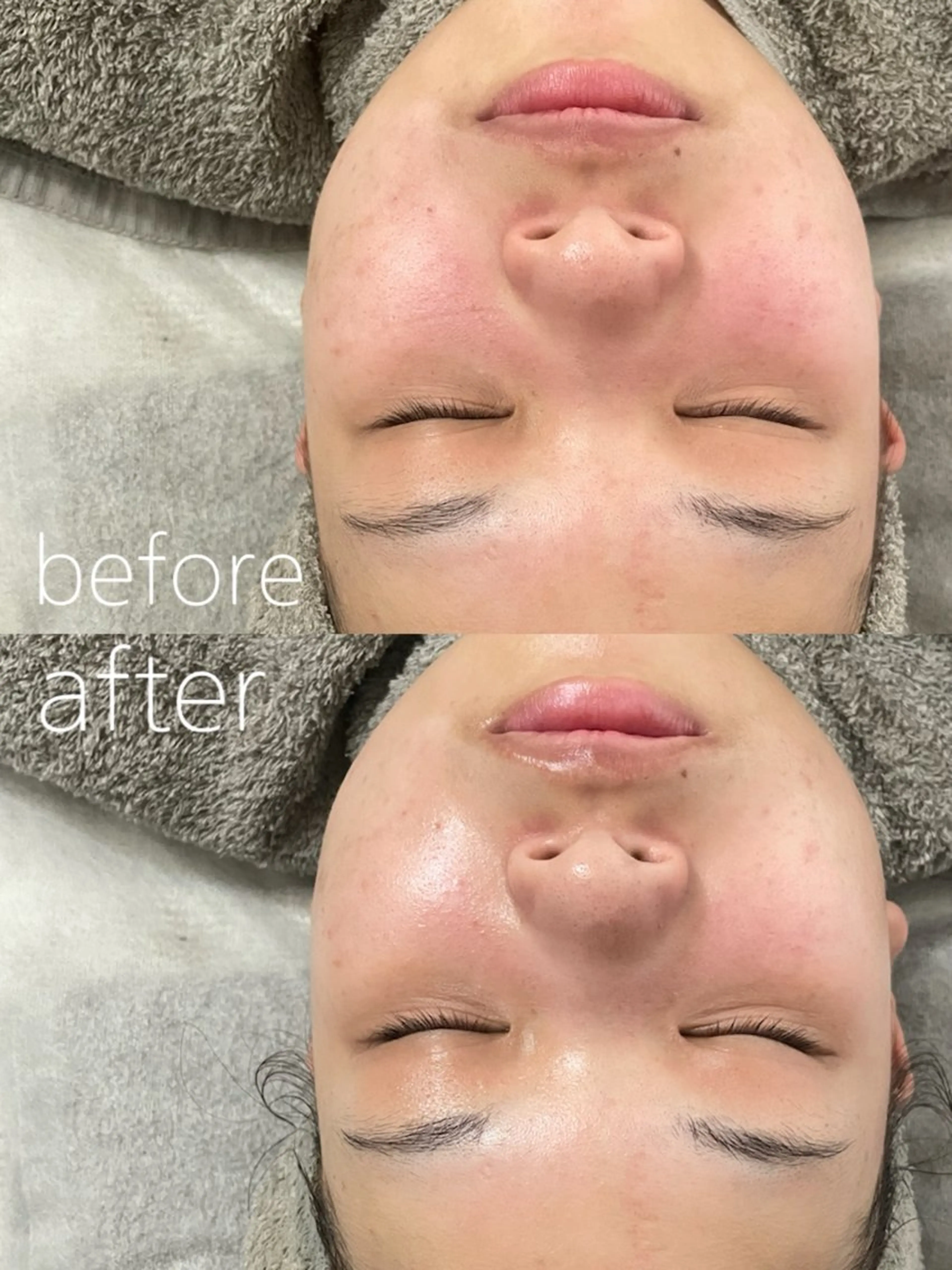 LBSホワイトニング 🌐岡山店のその他イメージ