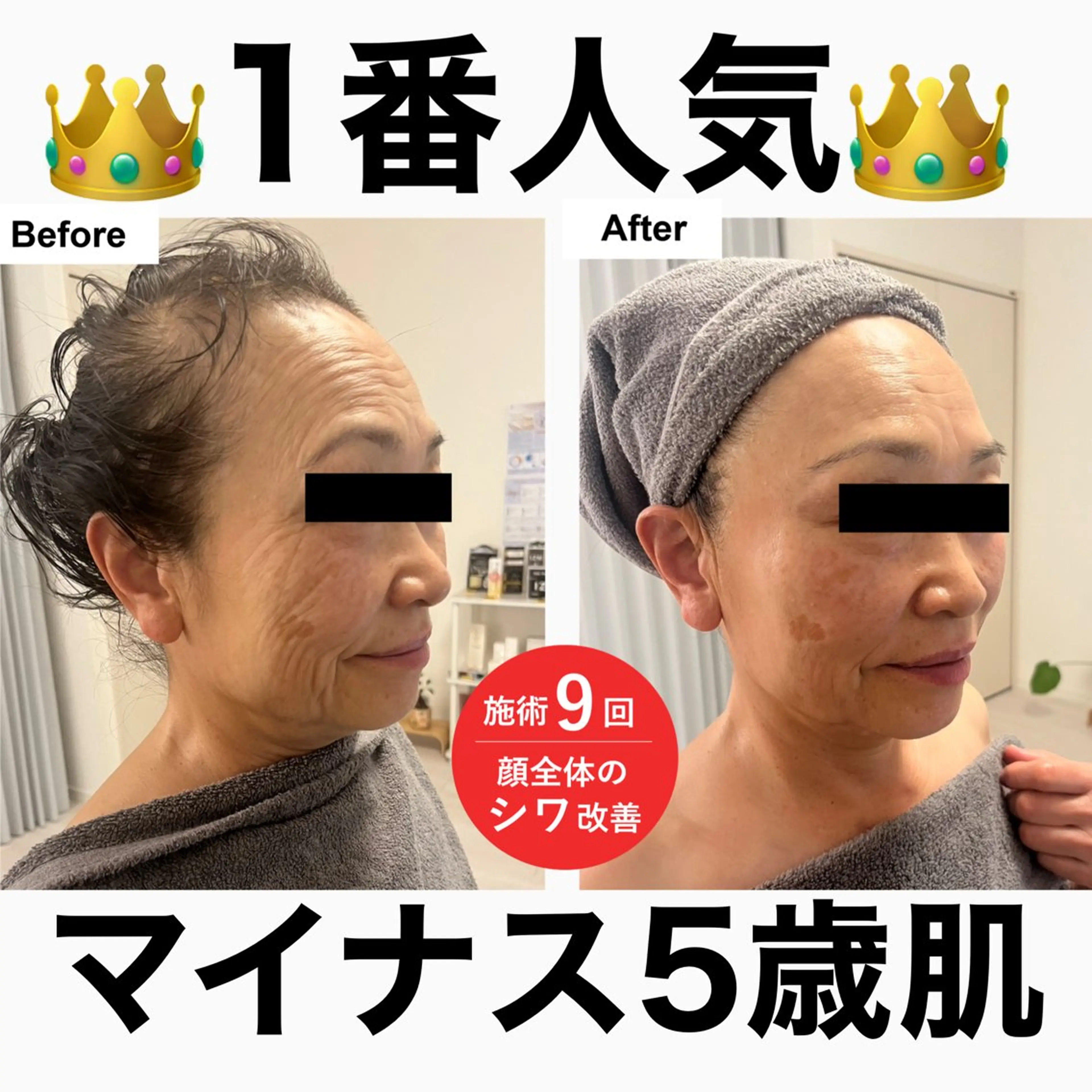 エステ 最速 毛穴シミ改善 いくえのエステ・リラクイメージ