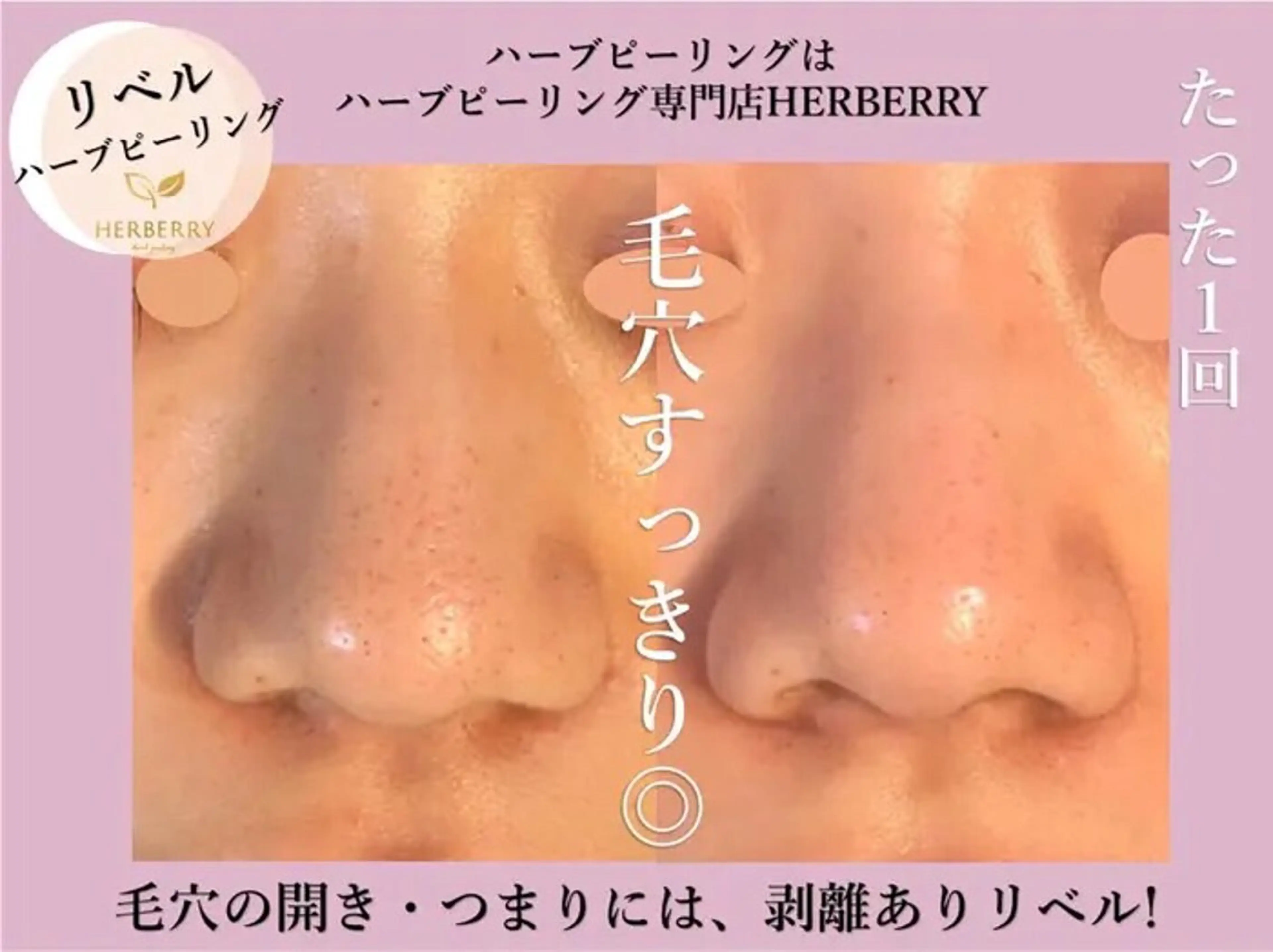 ハーブピーリング専門店HERBERRY難波心斎橋店所属・ハーブピーリング専門 HERBERRY冨永のエステ・リラクイメージ