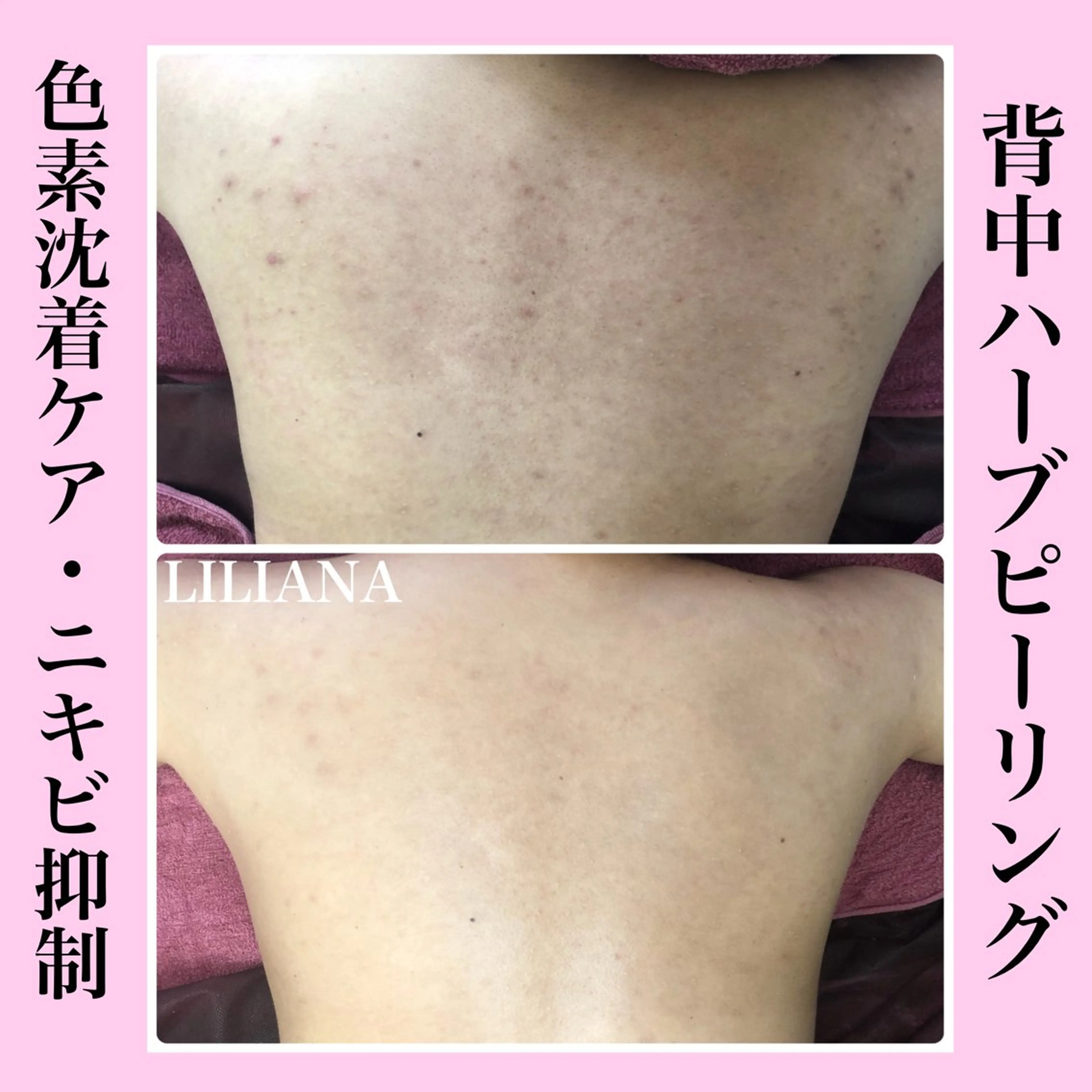 エステ LILIANA所属・LILIANA ☆YURIのエステ・リラクイメージ