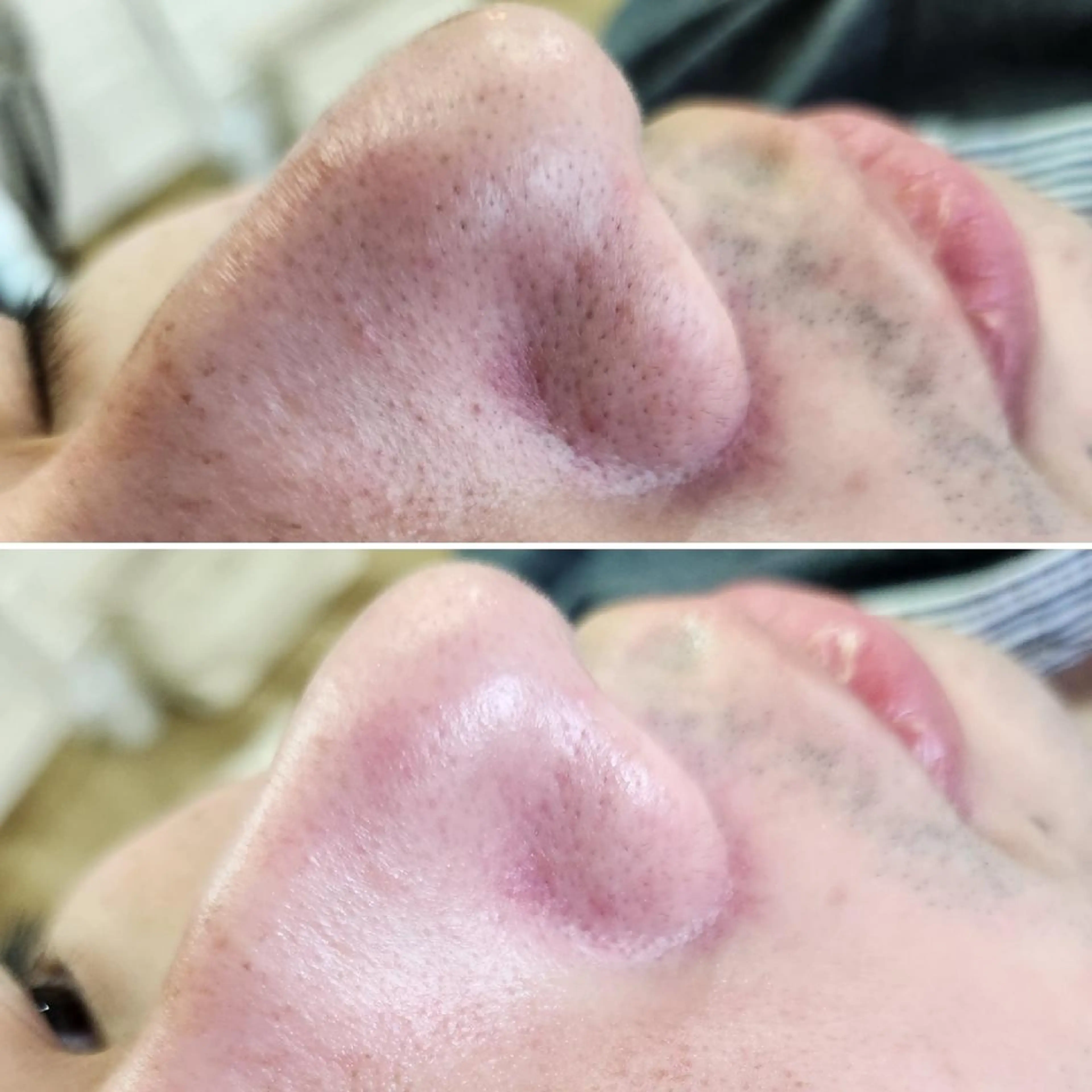 マツエク・マツパ アイブロウ ネイル メンズ エステ Anacia Beauty Salon所属・美肌脱毛&毛穴専門 Anaciaのエステ・リラクイメージ