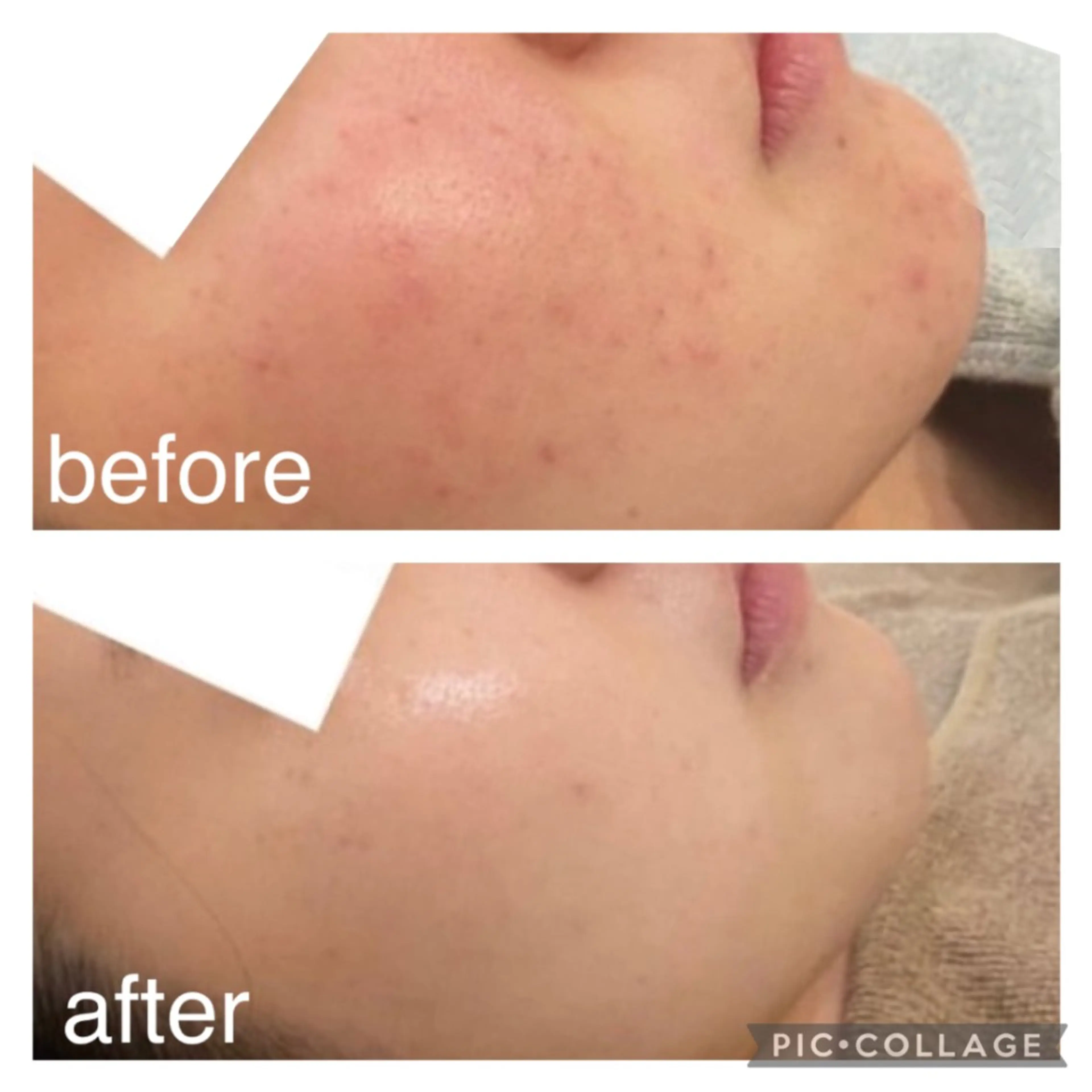 エステ aimee　肌質改善サロン【アイミー】所属・肌質改善サロン aimee｜アイミーのエステ・リラクイメージ