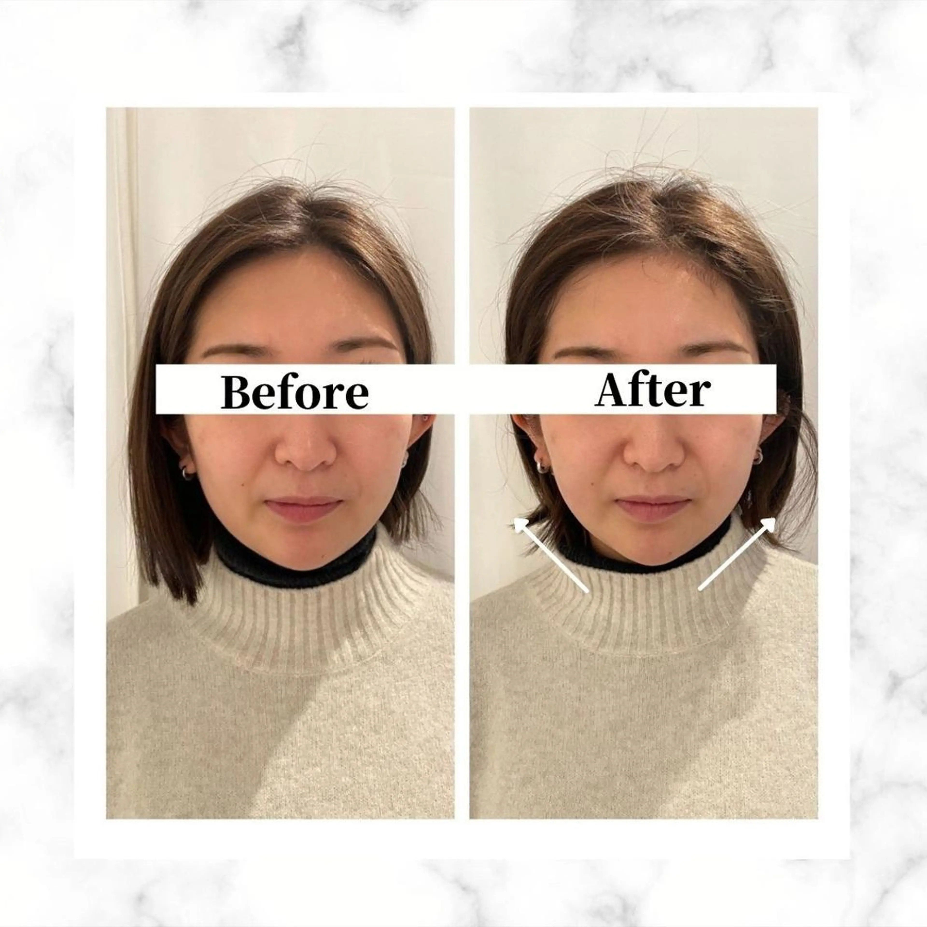 エステ リラク 12Dハイフ💗 最強小顔のエステ・リラクイメージ