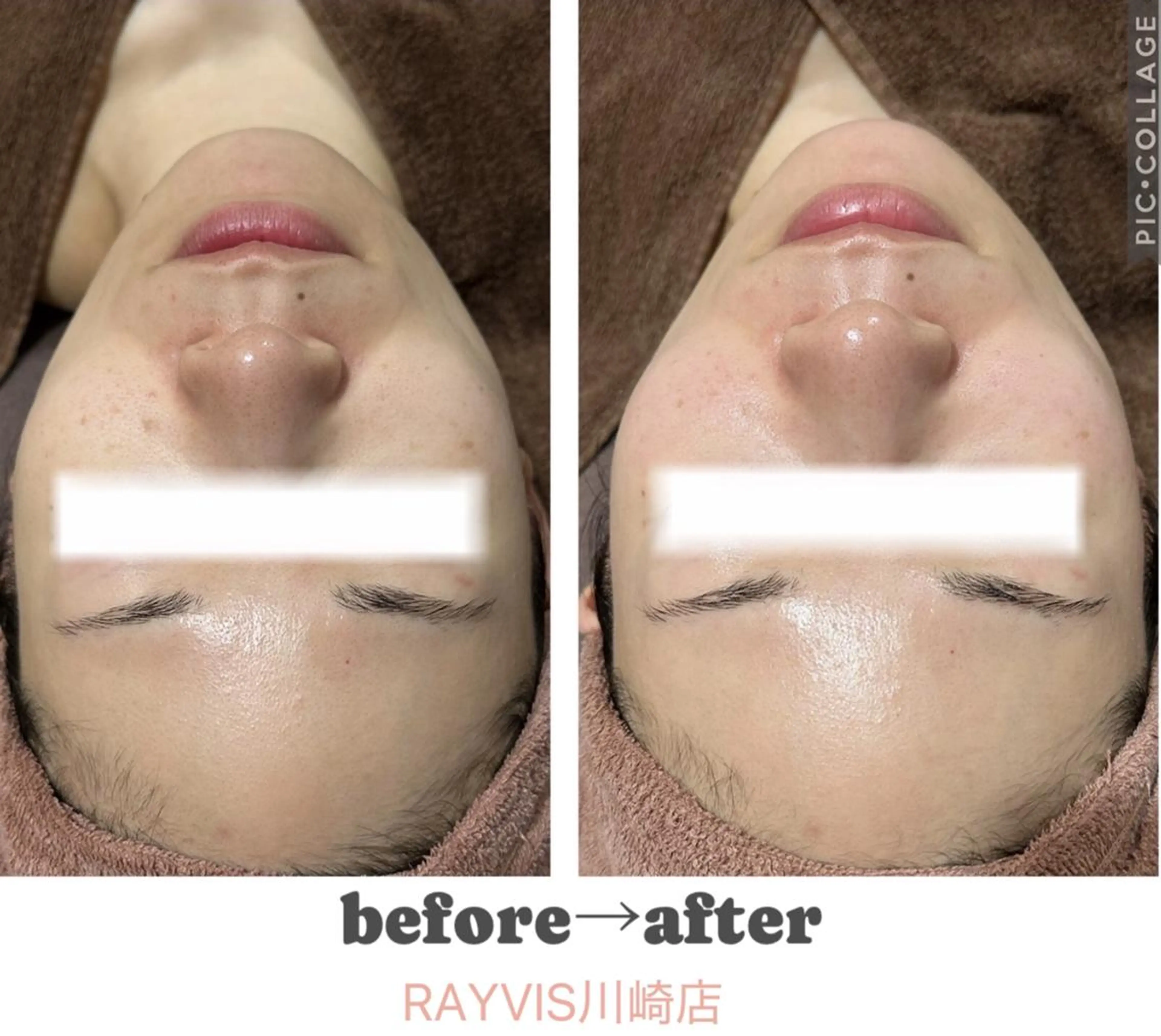 🌷U24毛穴エステ レイビス川崎🌷のエステ・リラクイメージ