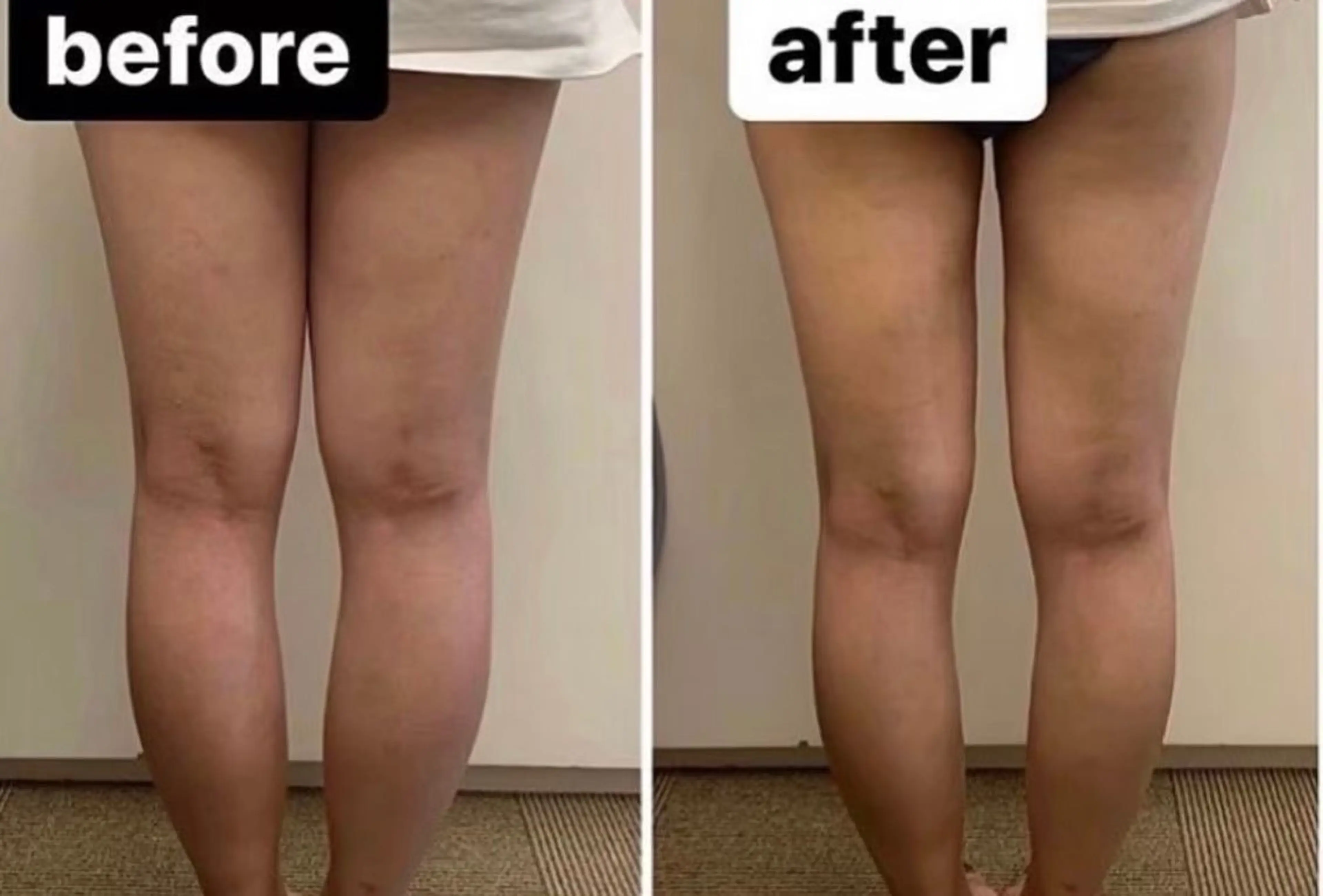 お試し【痩身】60分の写真