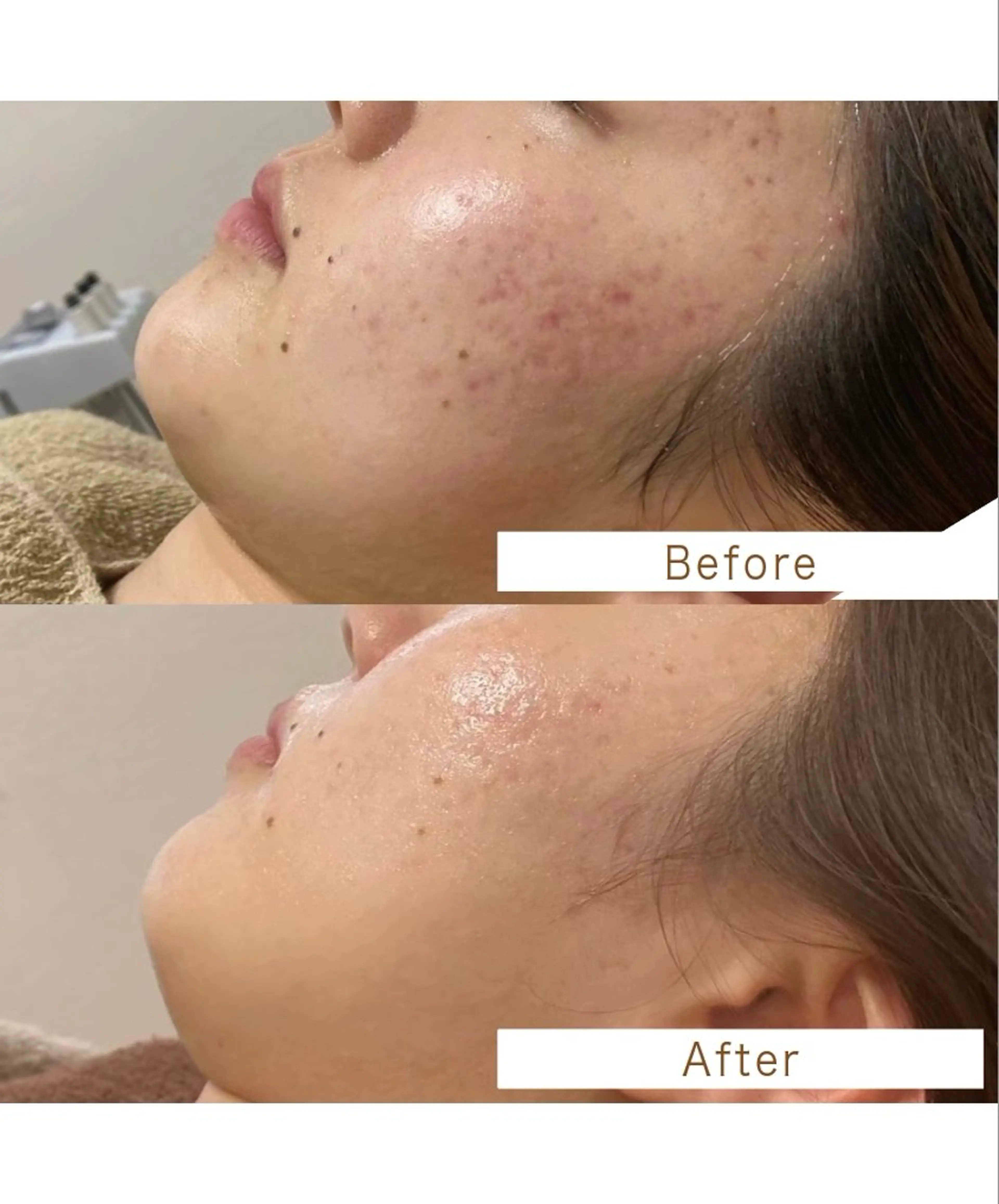 エステサロン .BXのエステ・リラクイメージ