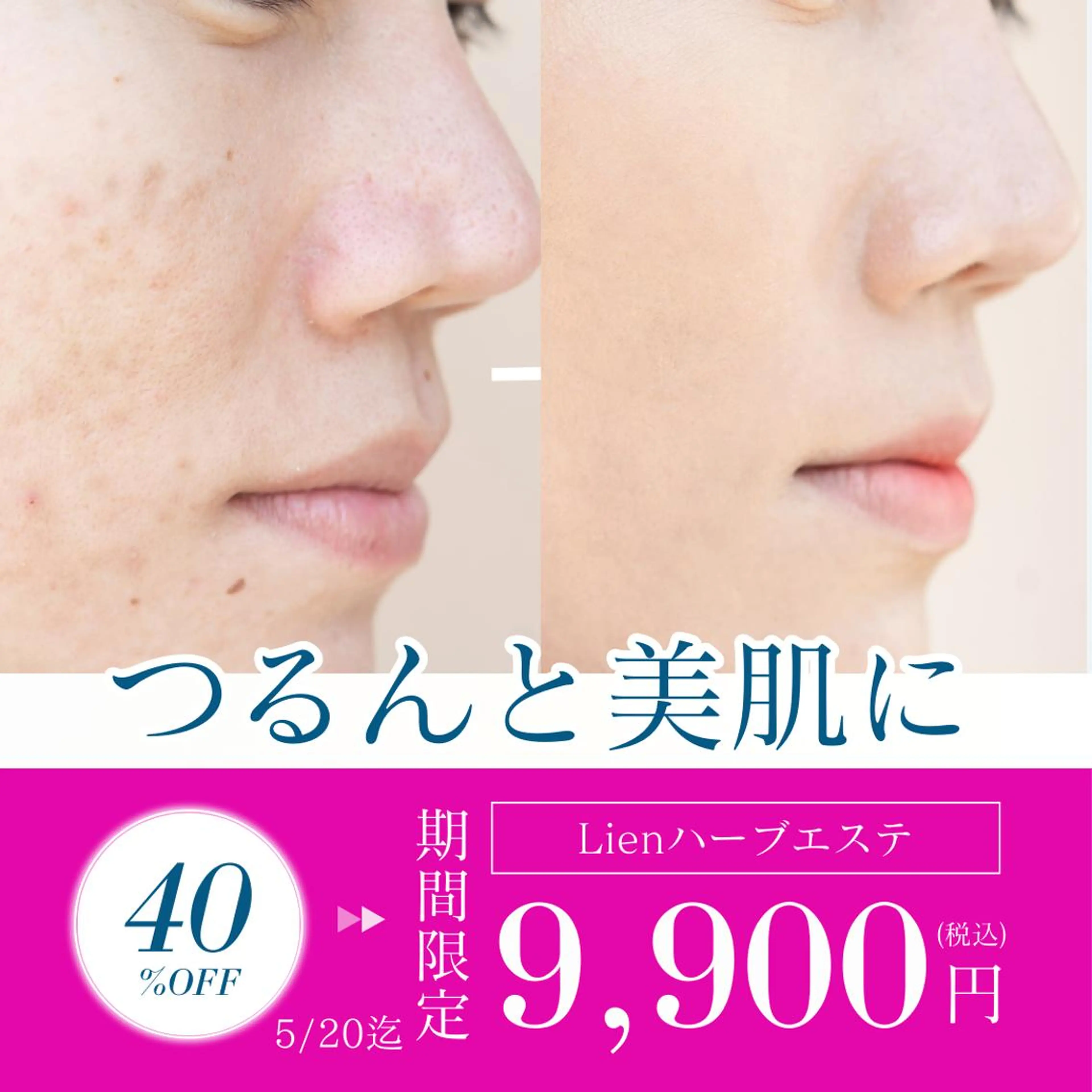 Lien オーナー　山口智嘉のエステ・リラクイメージ