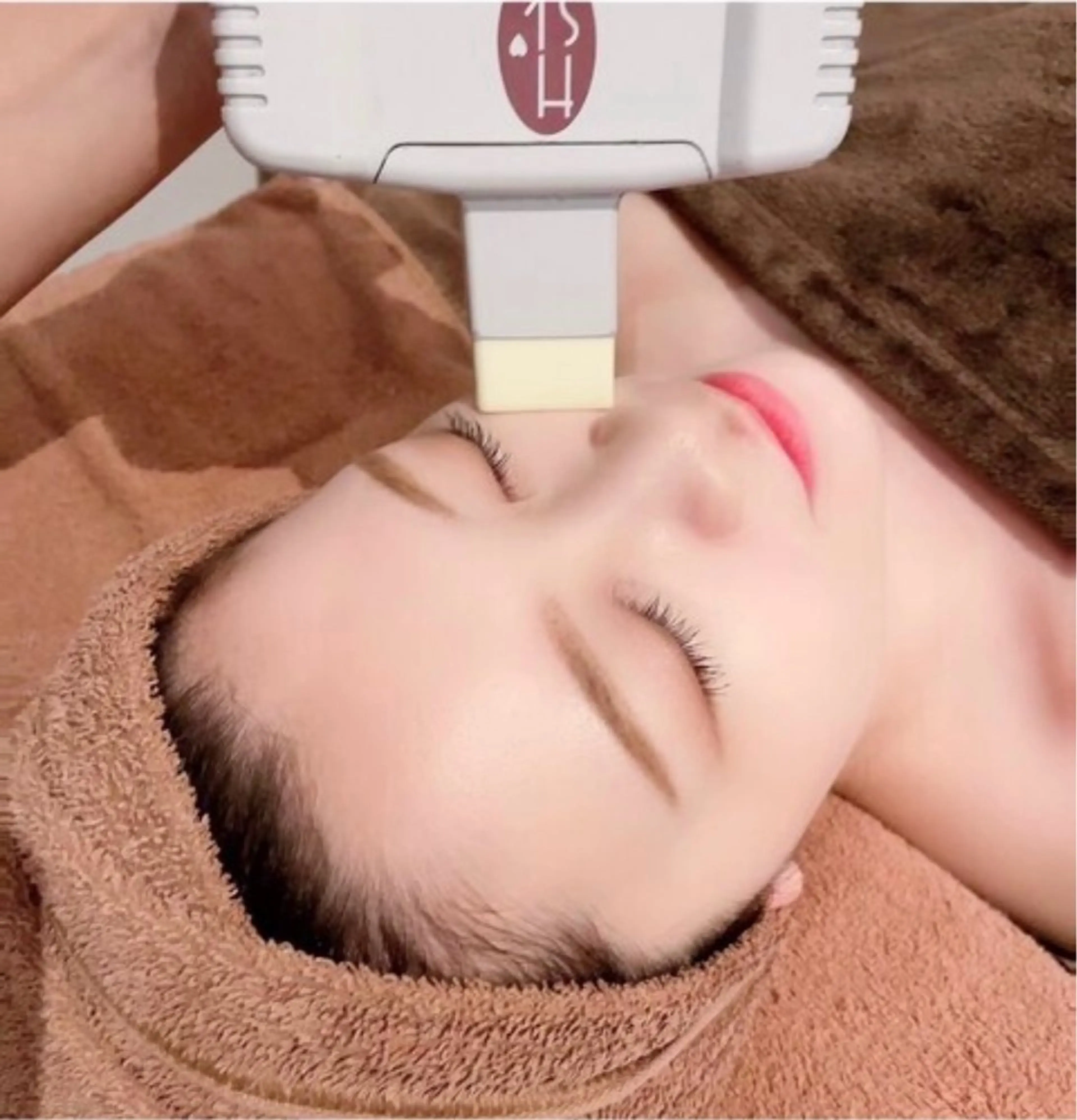 敏感肌の方におすすめ♪お顔まるごと脱毛+角質除去付きの写真