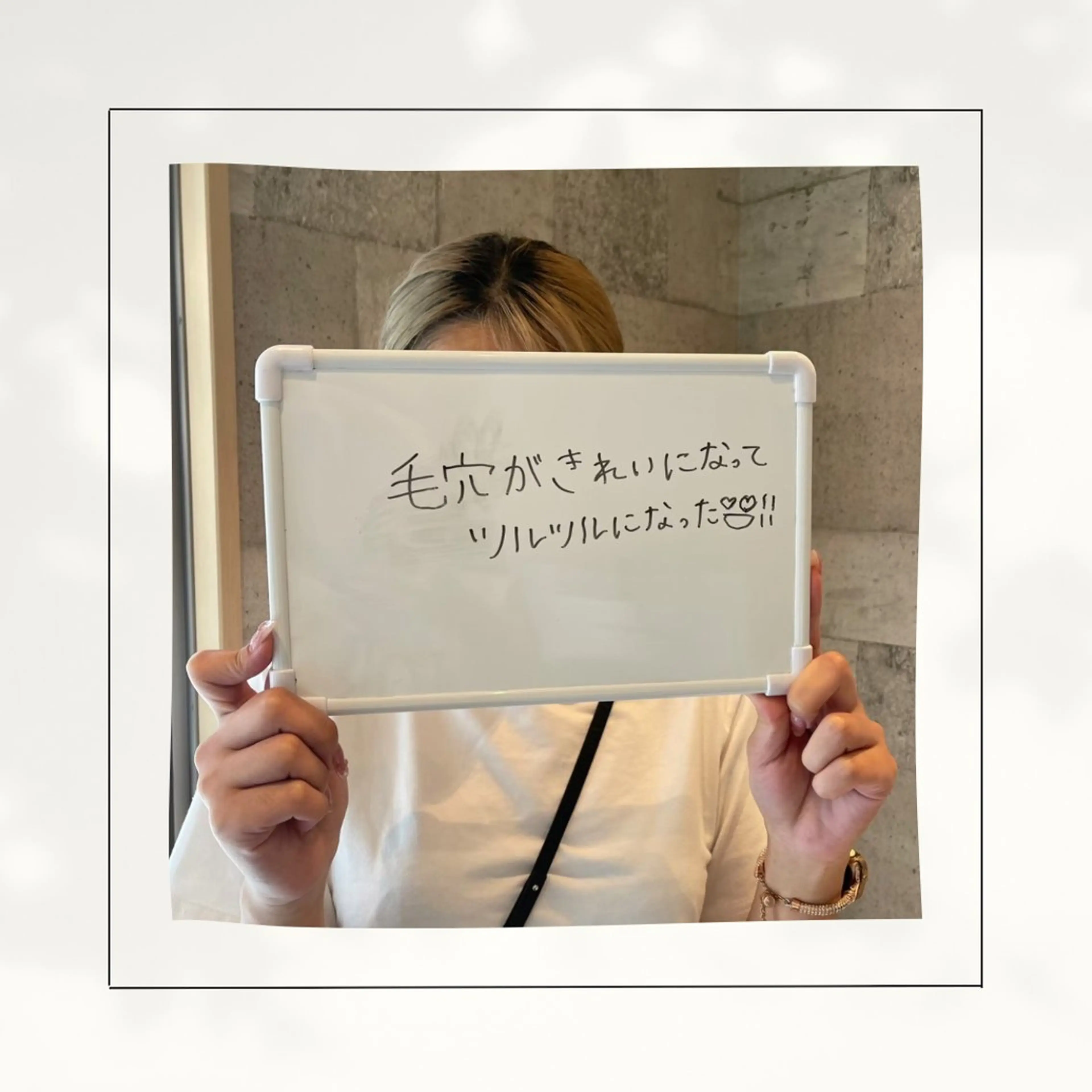 エステ シミ・毛穴専門店 gracia 宇土店所属・シミ・毛穴専門店 /gracia 安藤のエステ・リラクイメージ