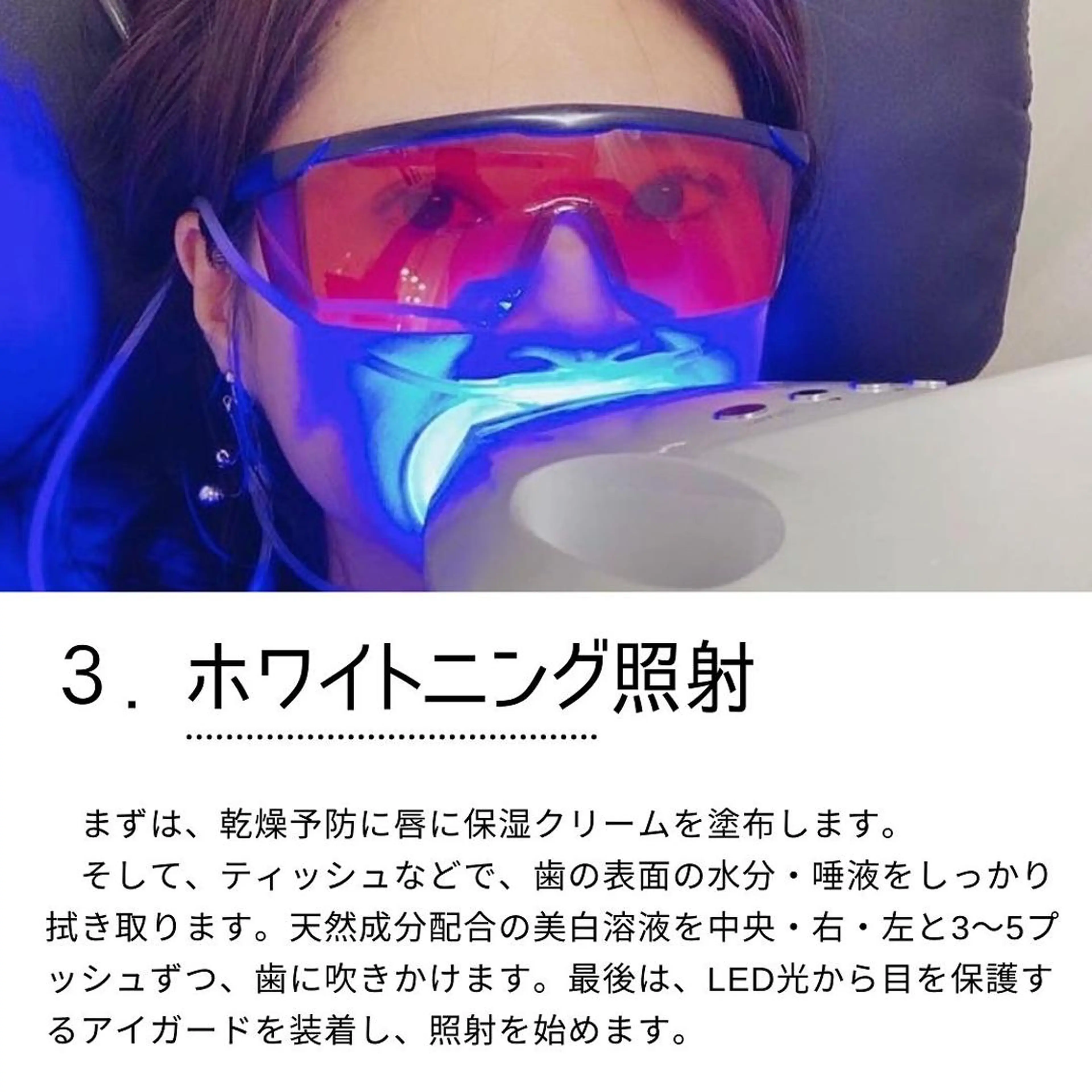✨💎人気No.2★口コミ投稿💎✨歯の美容美白セルフホワイトニング+高濃度水素吸入《サプリ付》20+10分の写真