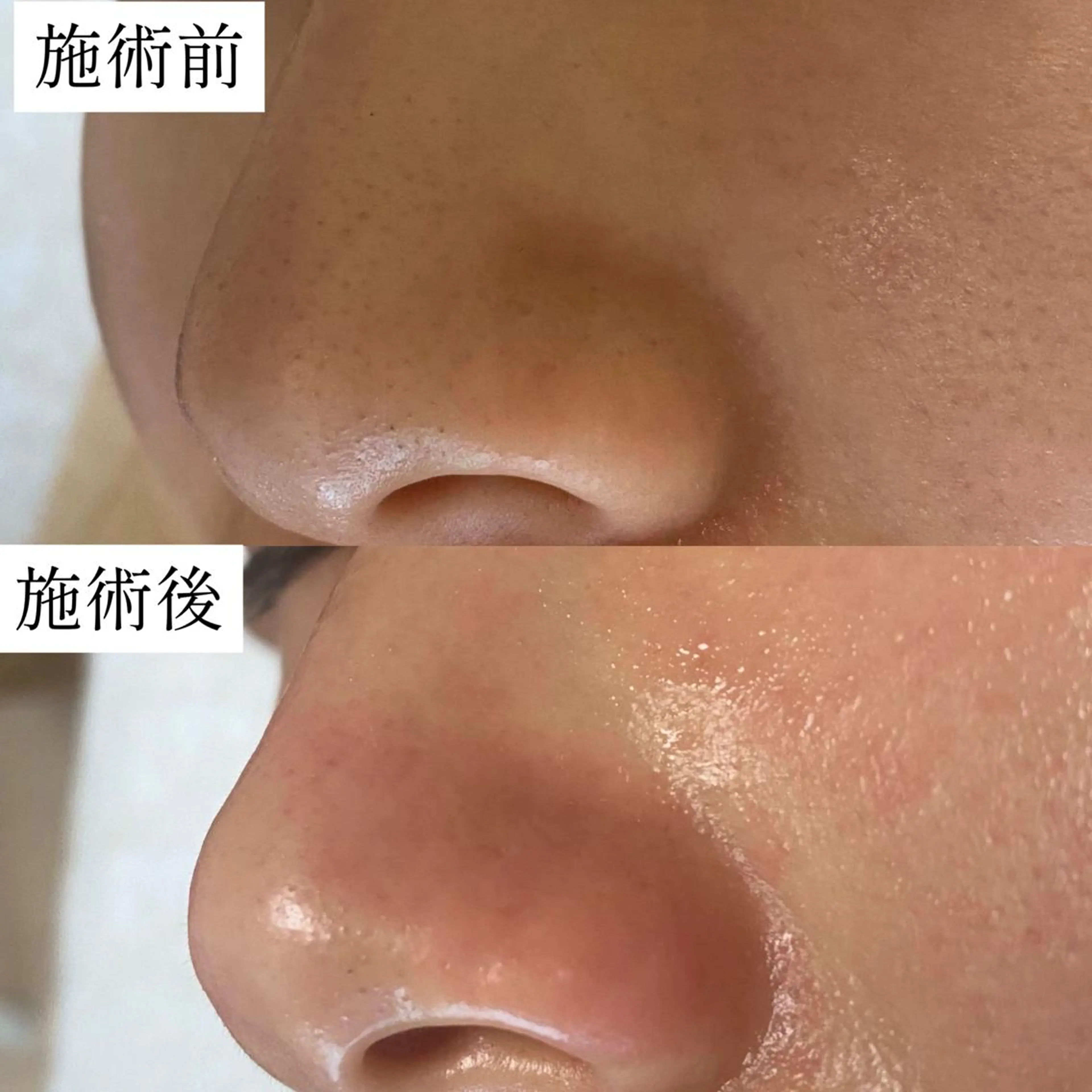 毛穴専門サロン　フルール所属・フルールFululu 自由が丘のエステ・リラクイメージ