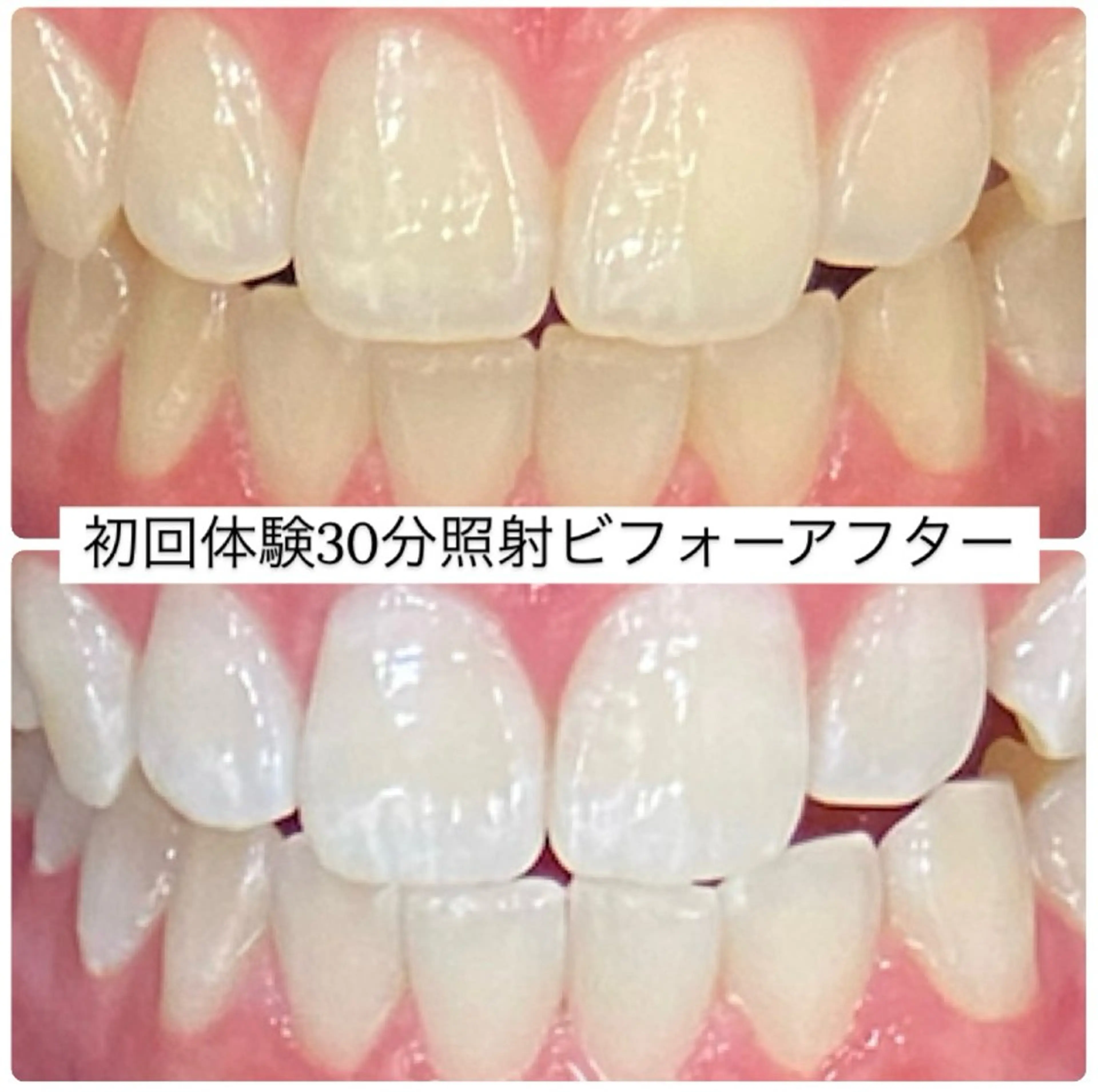 PLATINUM Beauty 横浜店所属・ホワイトニングルーム 横浜店のその他イメージ